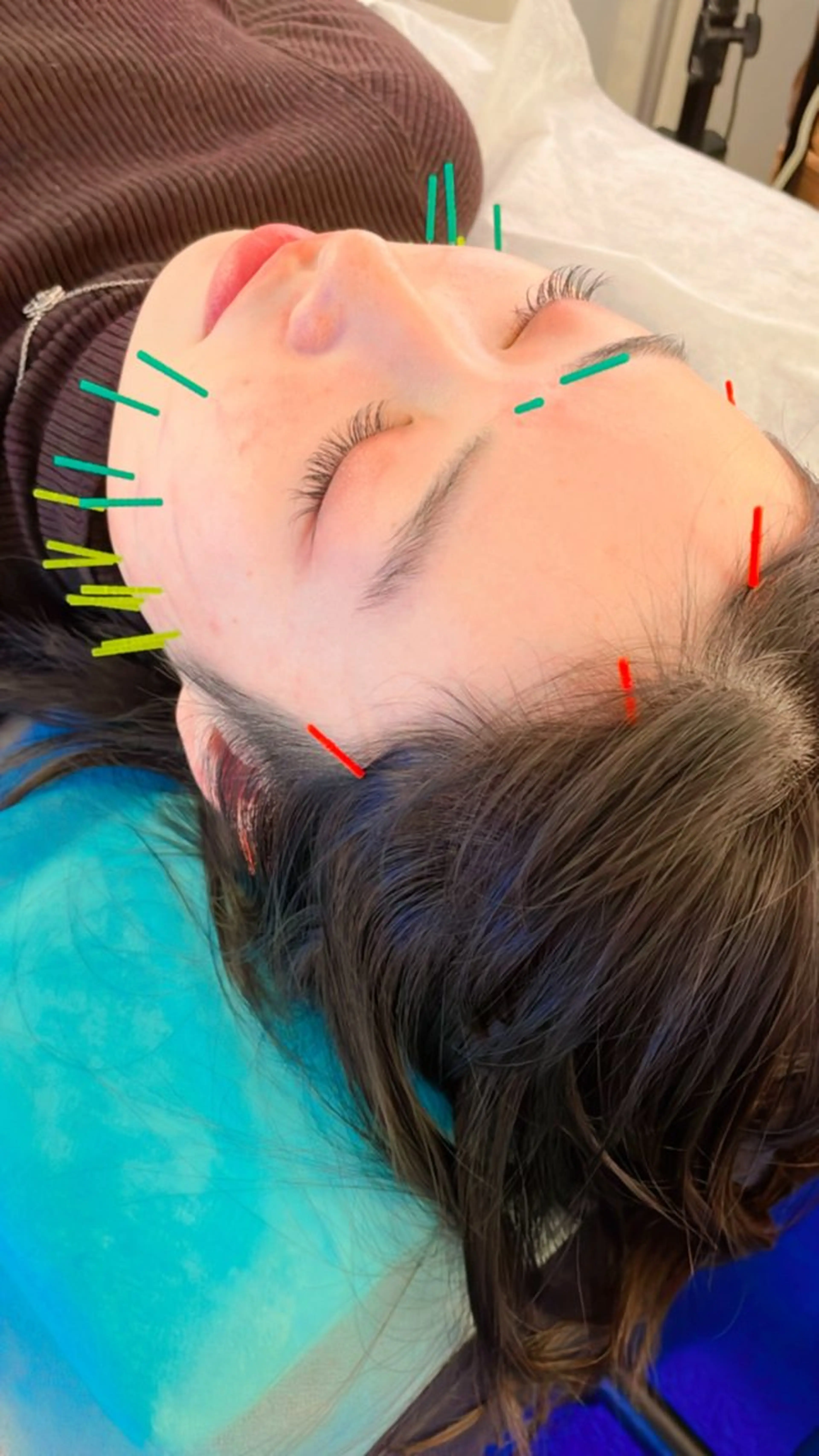 エステ リラク 小顔美容鍼専門サロン 渋谷YZのエステ・リラクイメージ