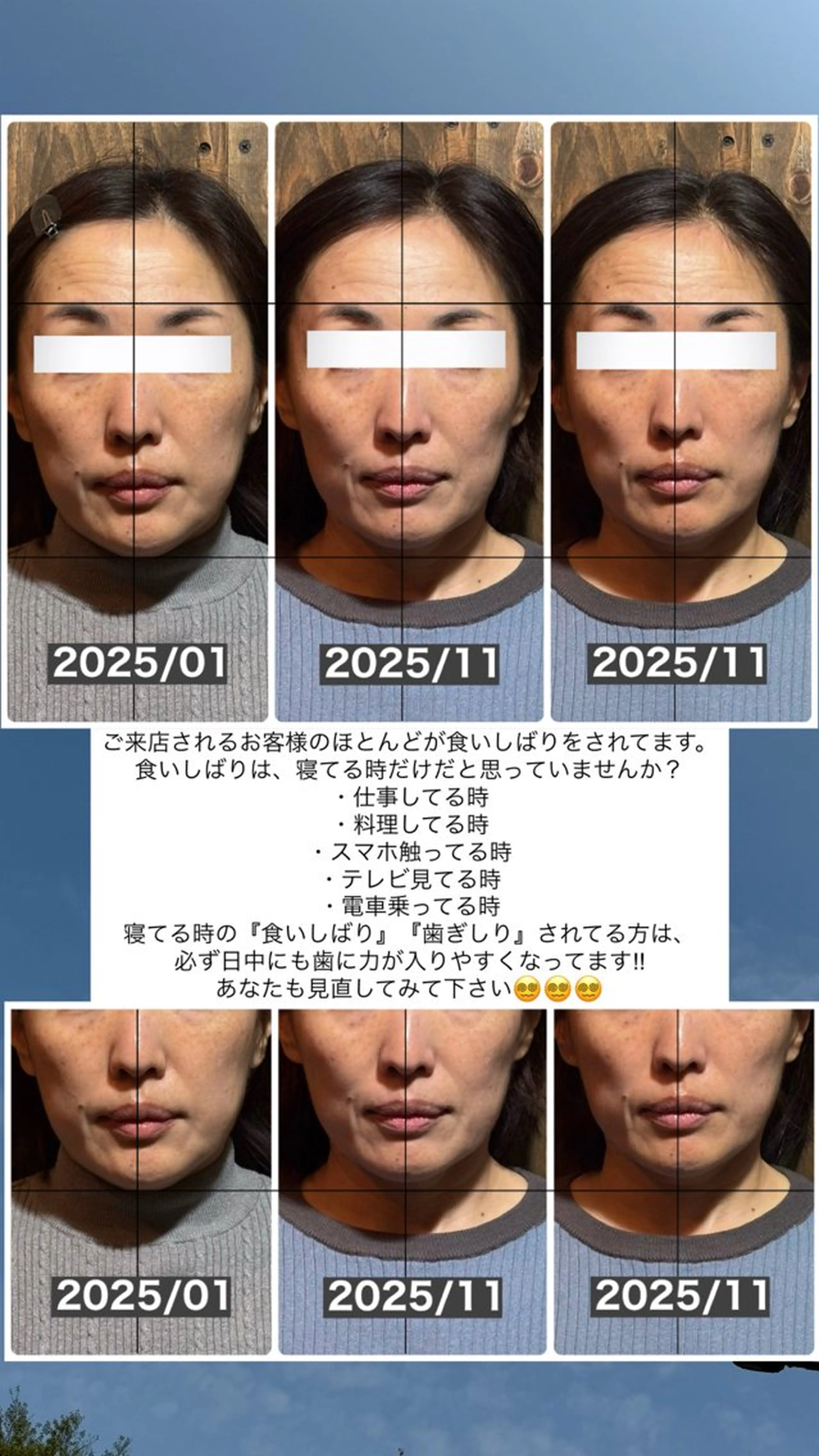 エステ リラク 💎後悔させない小顔 矯正💎イトヤマ🌱のエステ・リラクイメージ