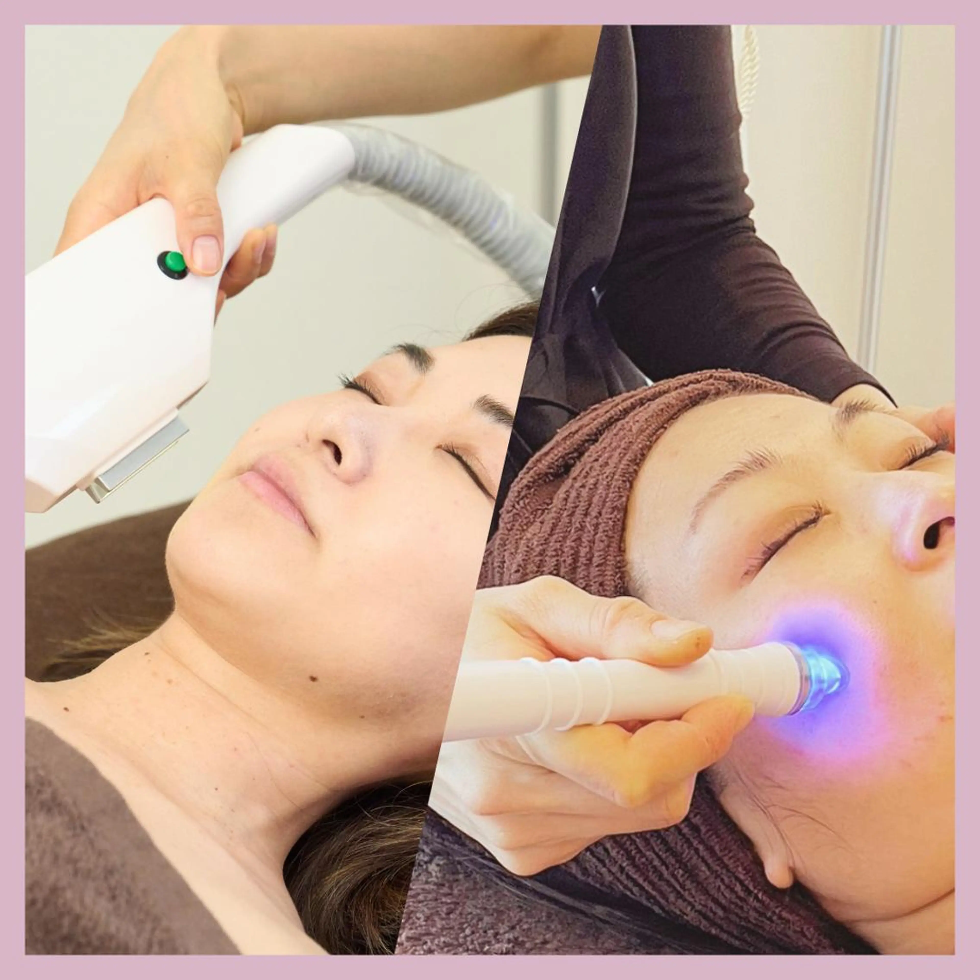 【速攻ツヤ肌✨】アクアピーリング(毛穴洗浄)+光フェイシャル🌟フェイシャルパック付きの写真