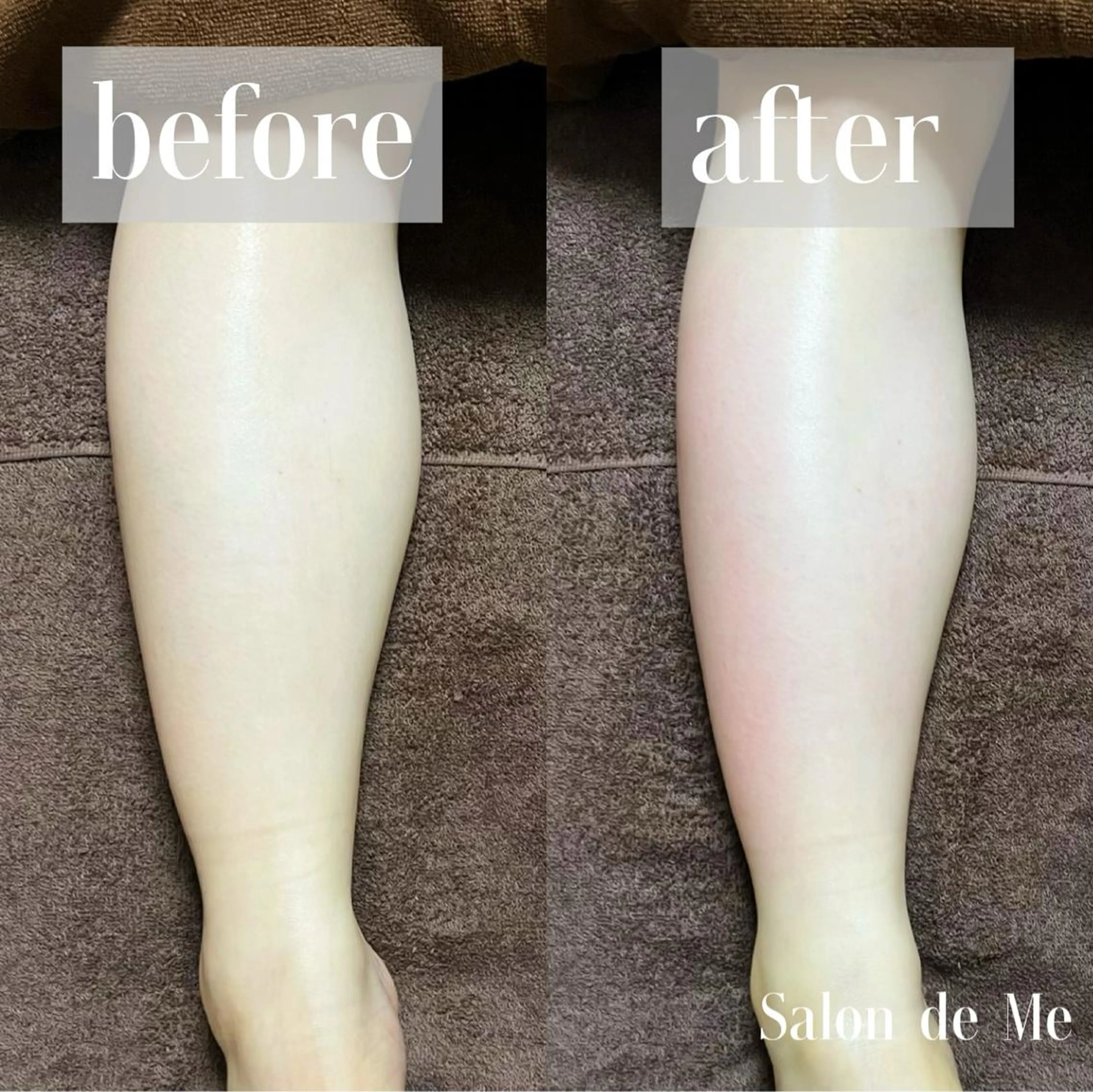 エステ Salon de Me所属・💫Salon de Me💫予約停止中のエステ・リラクイメージ