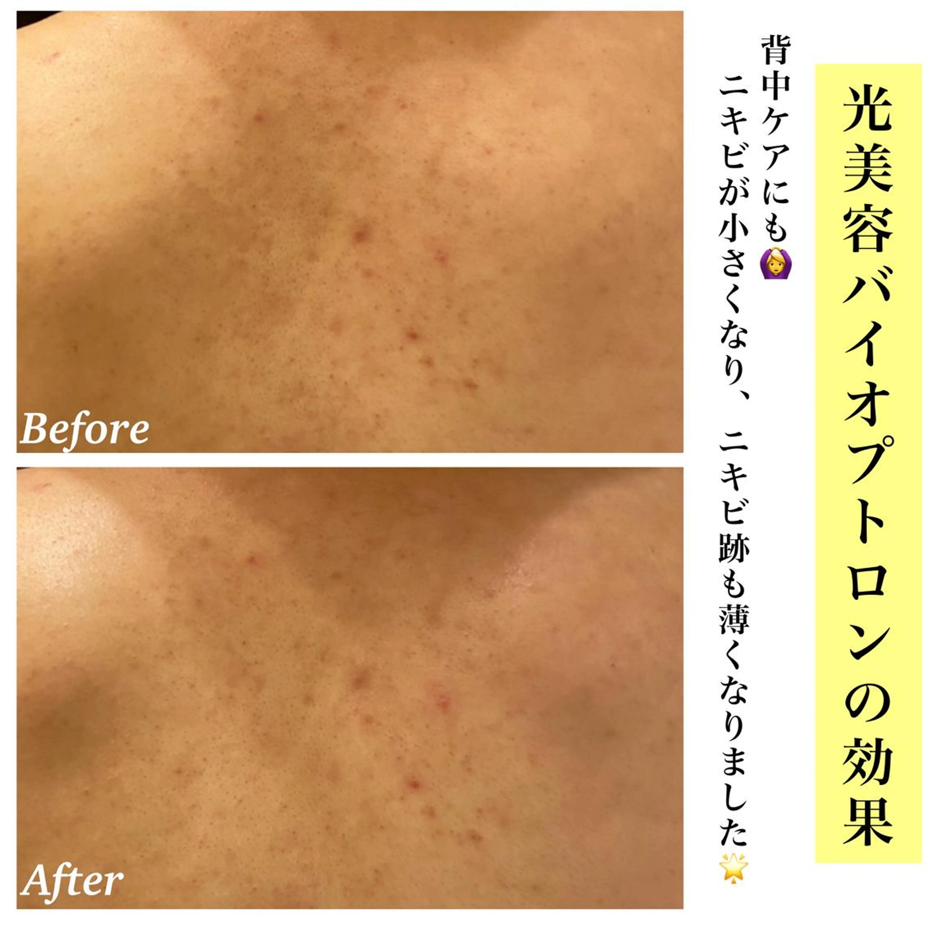 エステ リラク Bellesthe （ベルエステ）のエステ・リラクイメージ