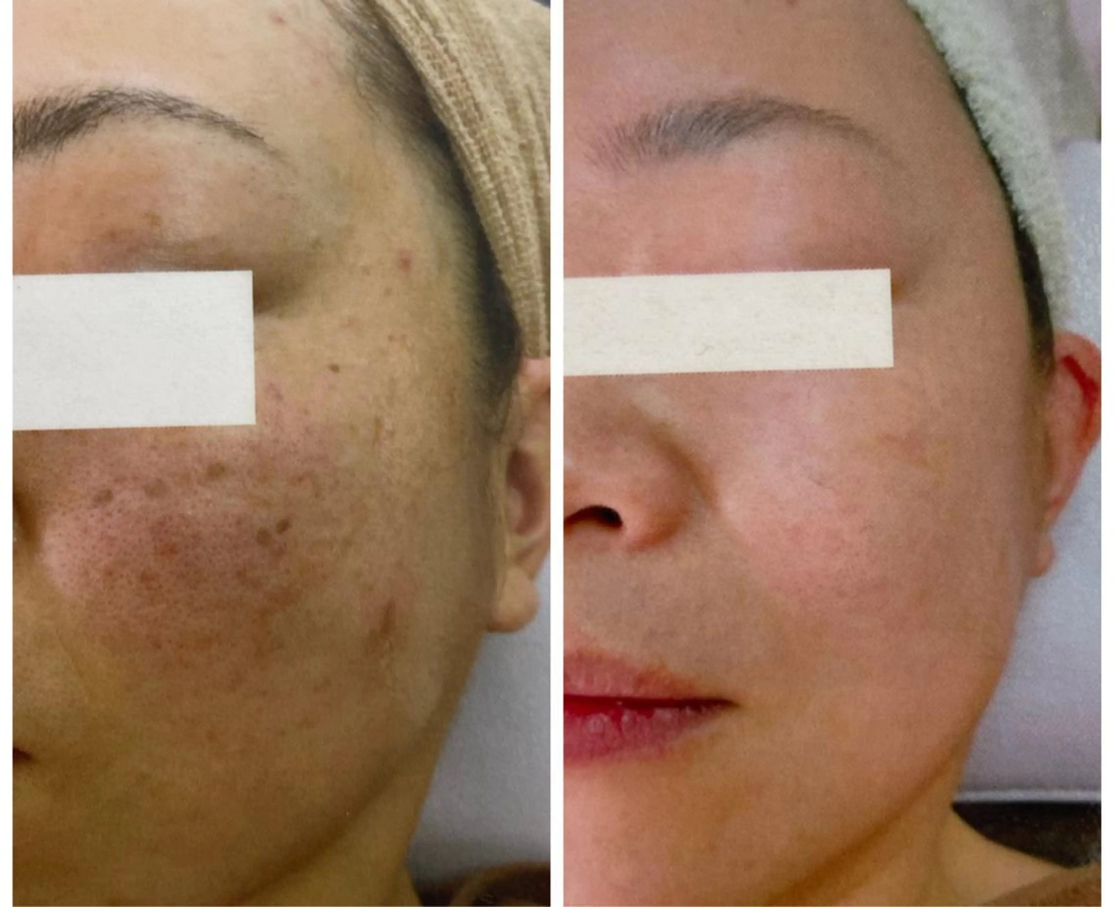 エステ TIERRA(ティエラ)所属・TIERRA ♡のエステ・リラクイメージ