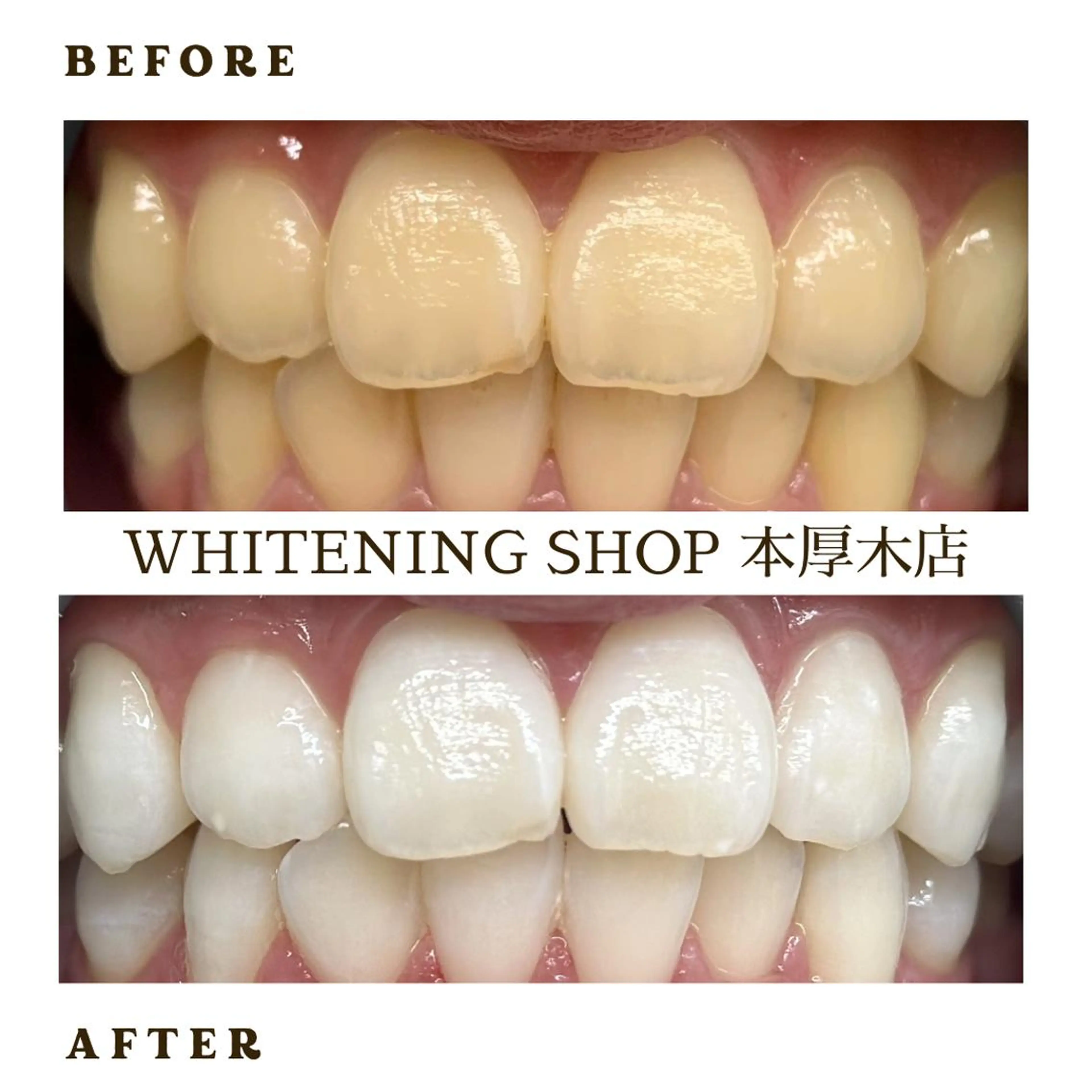 メンズ その他 ホワイトニング ショップ本厚木のその他イメージ