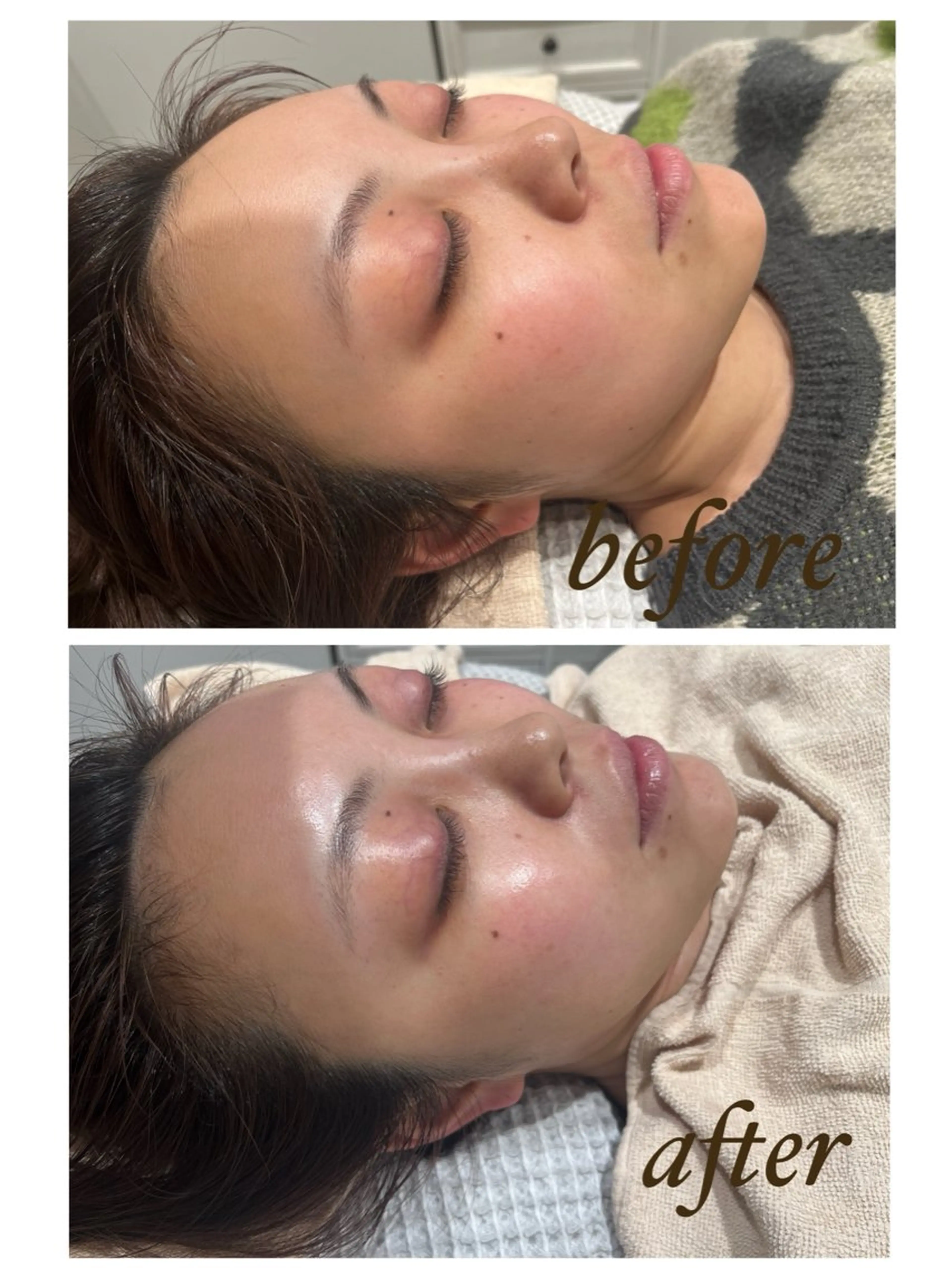 エステ 柳川 瑠花のエステ・リラクイメージ