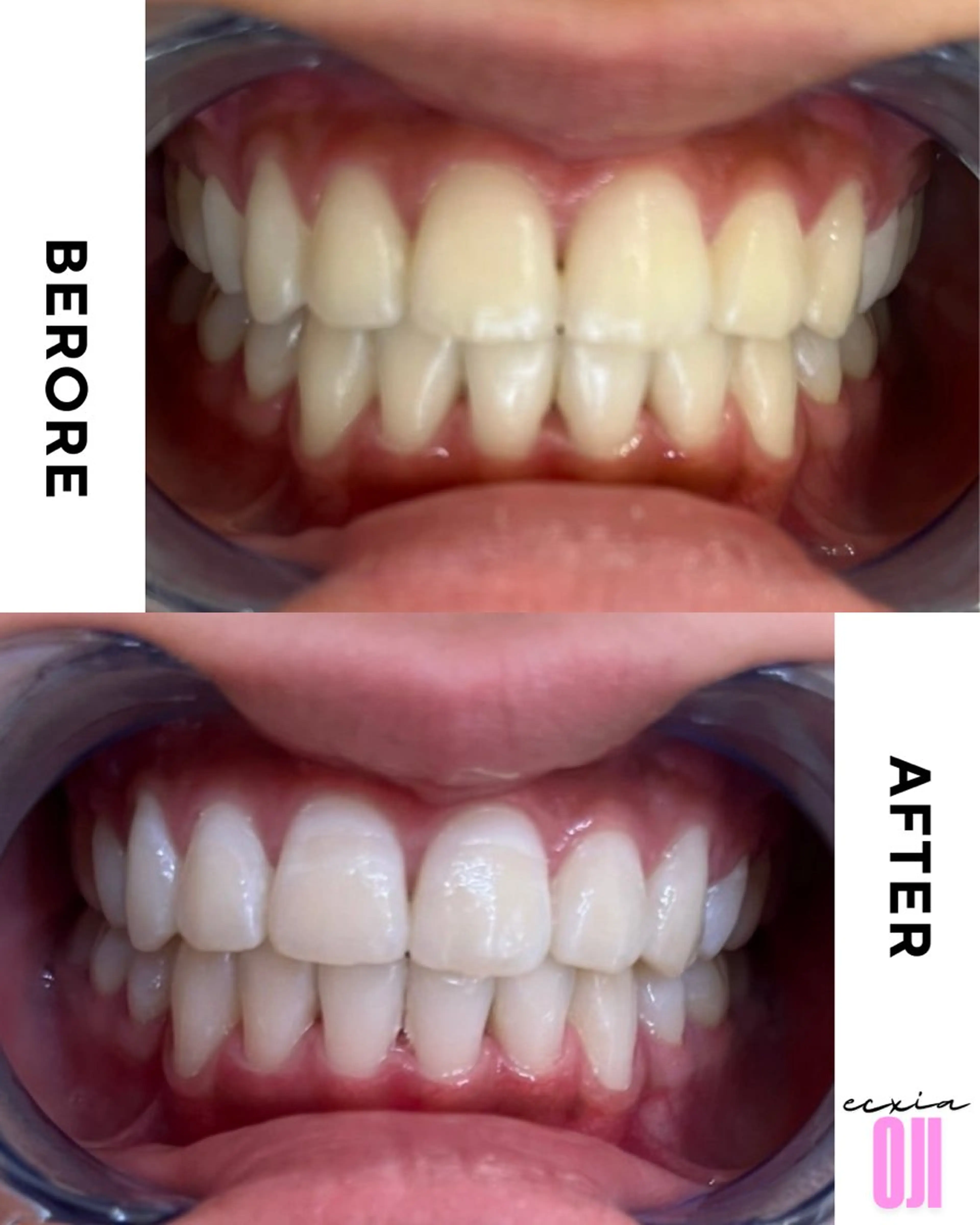 セルフホワイトニングサロン  エクシアホワイト 王寺店所属・エクシア王寺 NISHIKAWAのその他イメージ