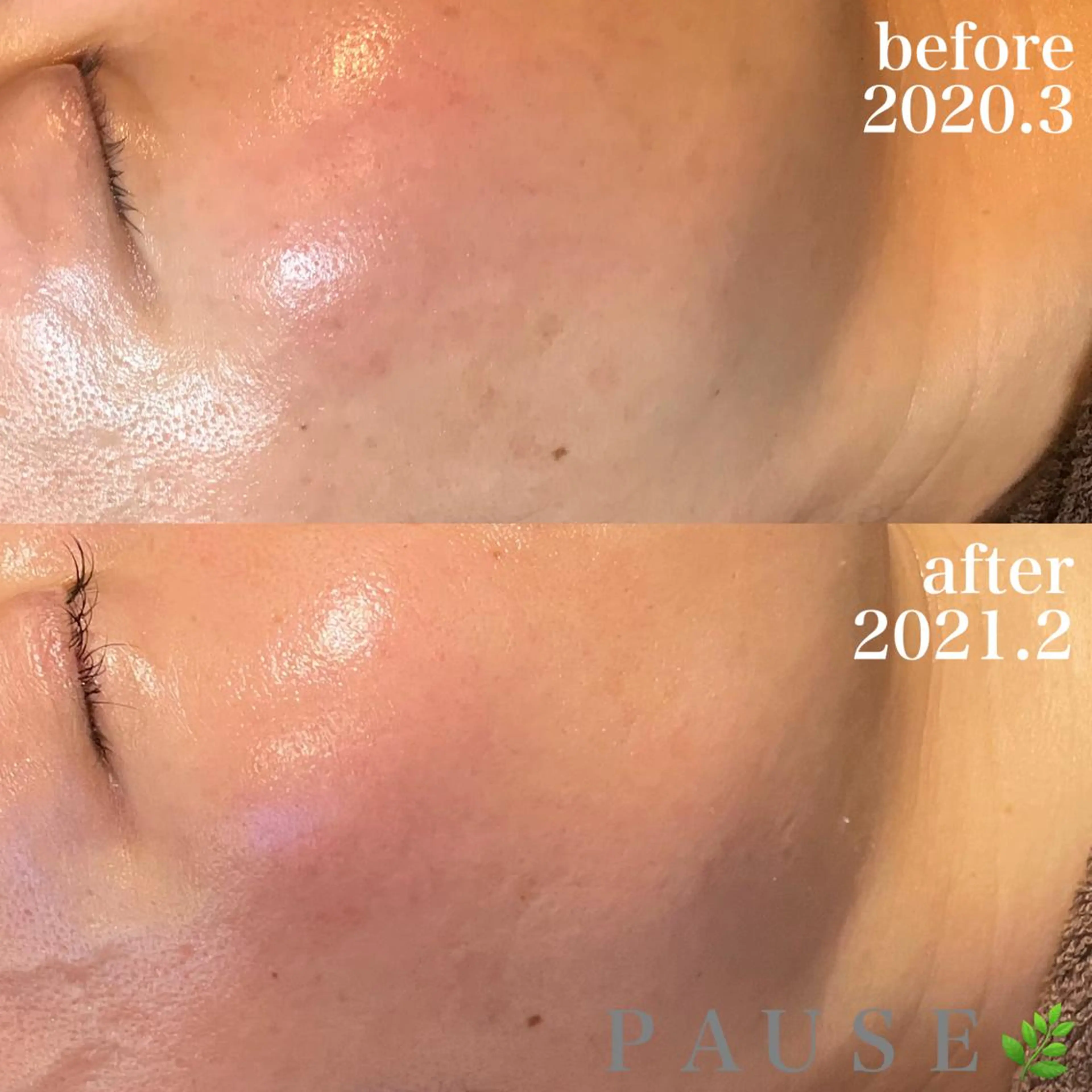 エステ 浜野 恵美のエステ・リラクイメージ