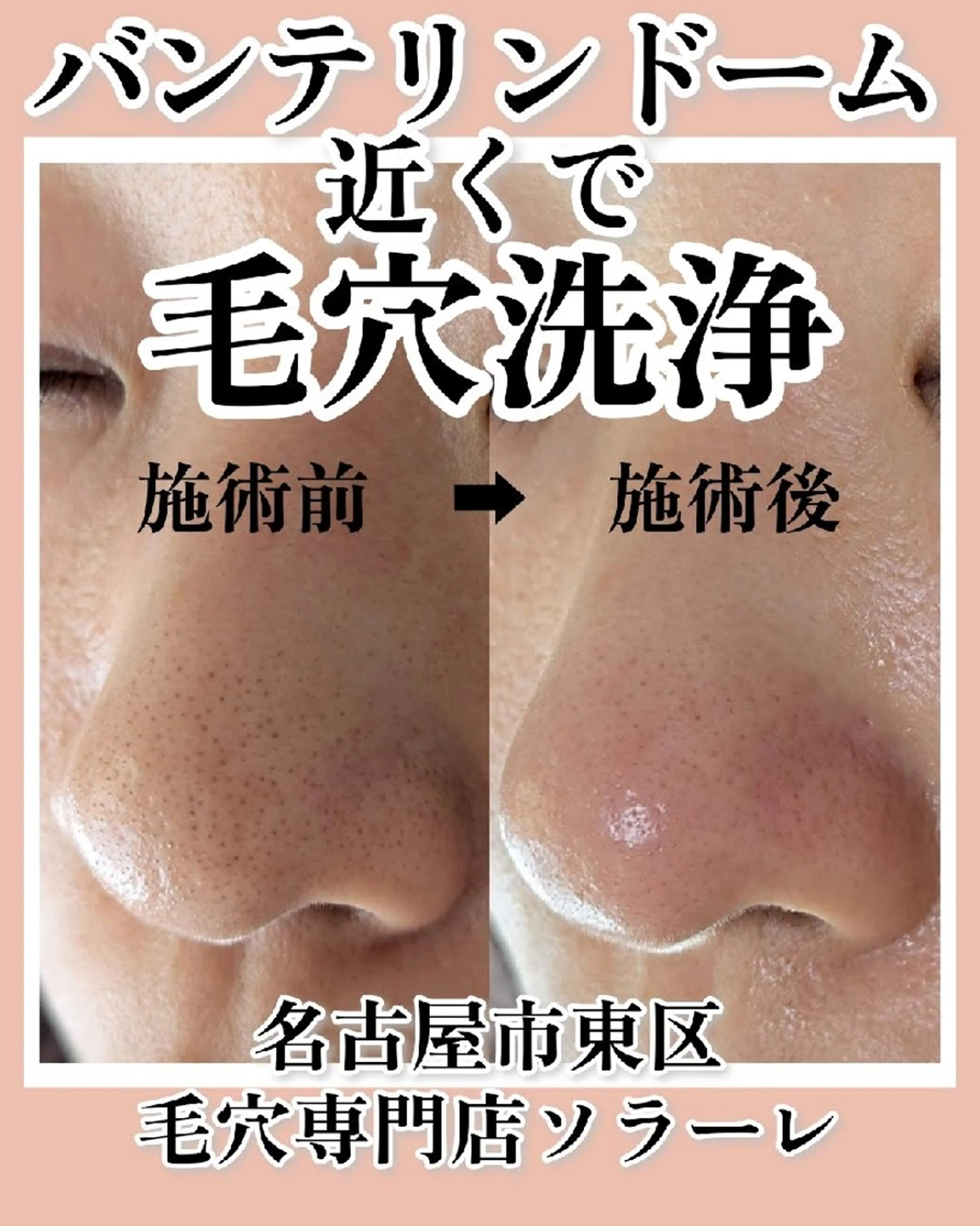  毛穴洗浄・まつ毛 の専門店 ソラーレのエステ・リラクイメージ