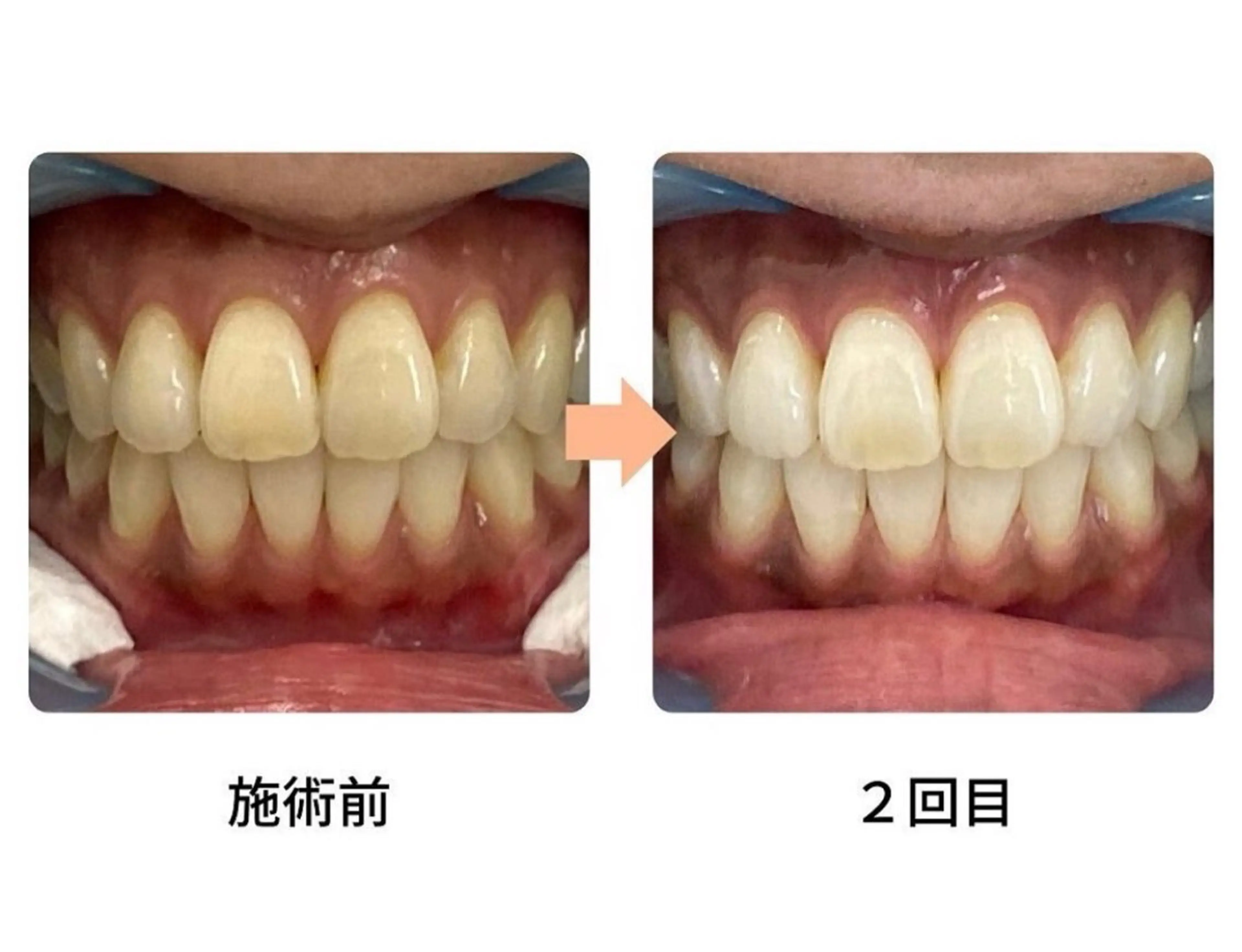 メンズ脱毛サロンReyz（レイズ）所属・熊本メンズ脱毛サロン Reyz（レイズ）のエステ・リラクイメージ