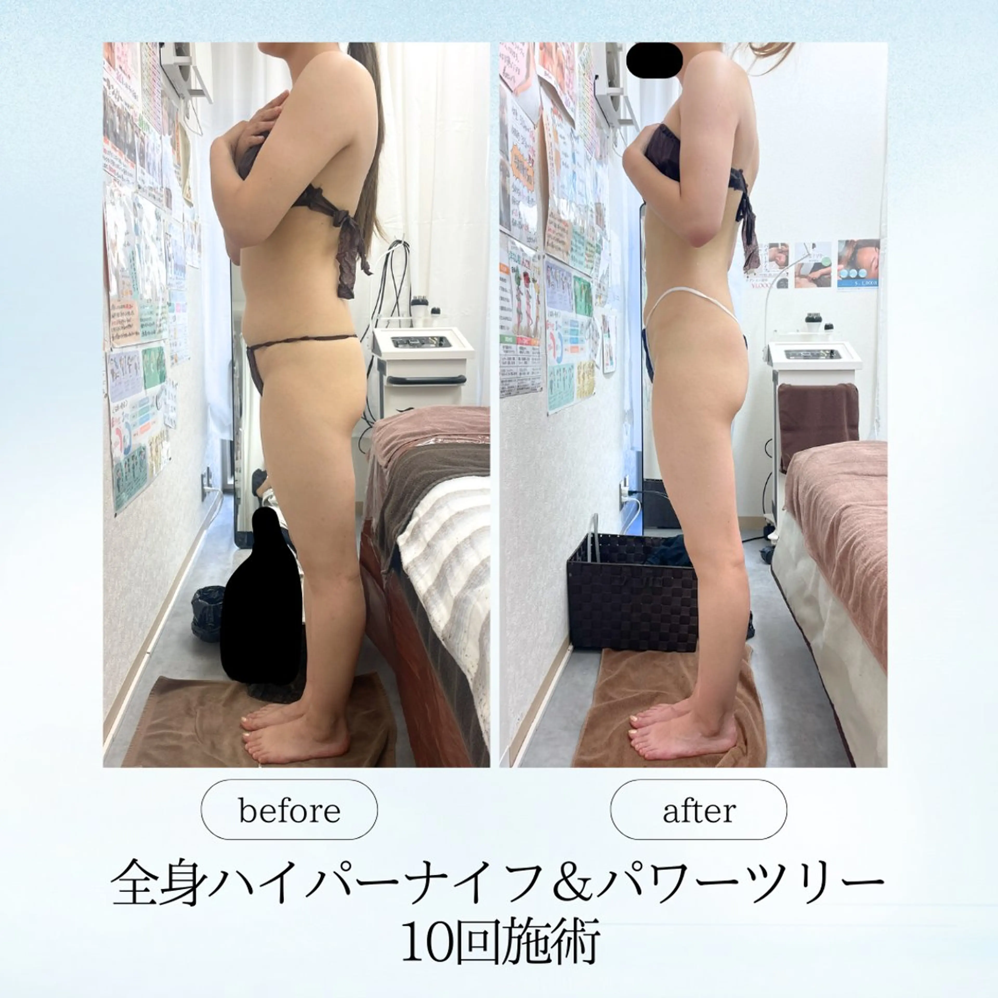 エステ リラク espresso,所属・《痩身、小顔専門店》 エスプレッソのエステ・リラクイメージ