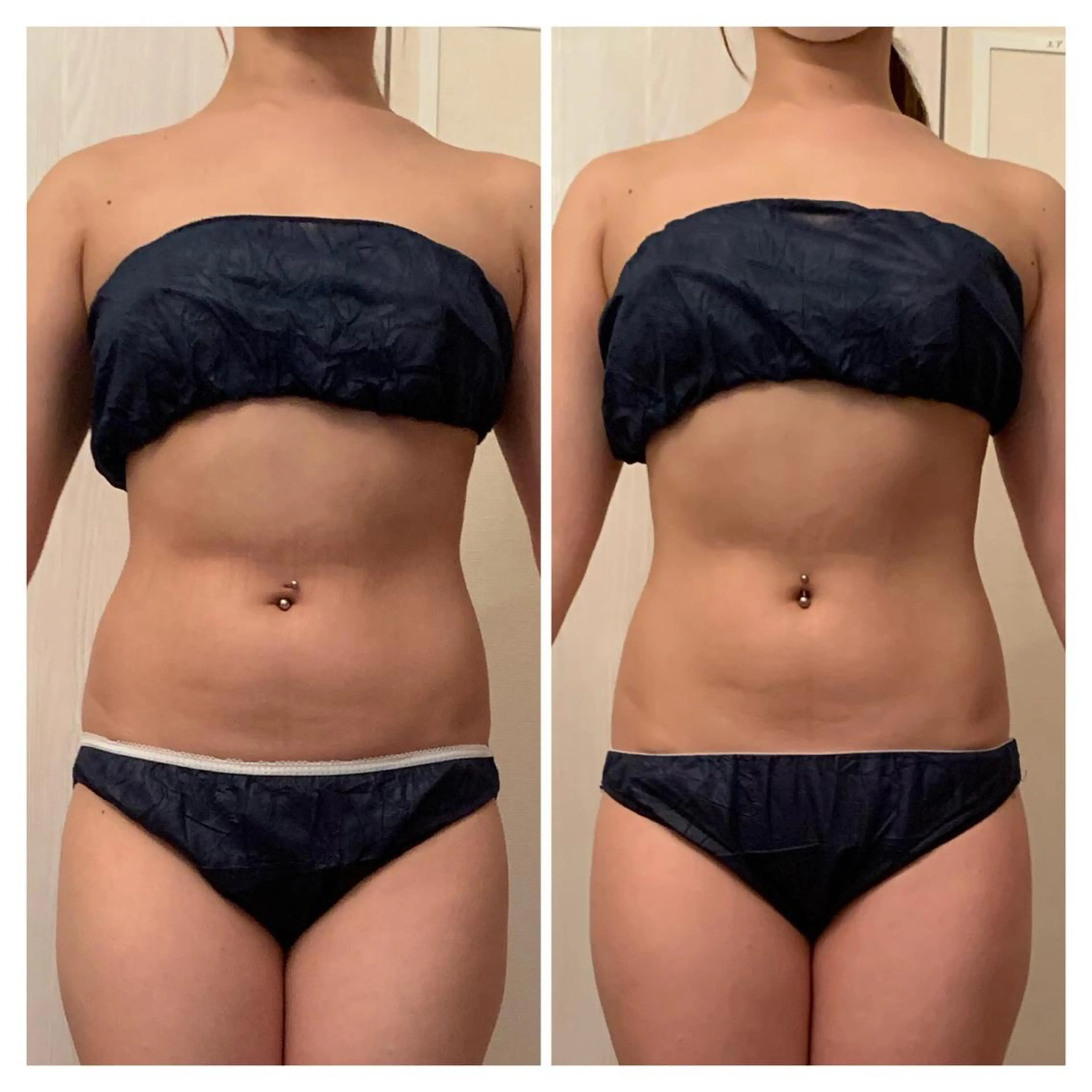 食べながら魅せボディ éclatJua川越のエステ・リラクイメージ