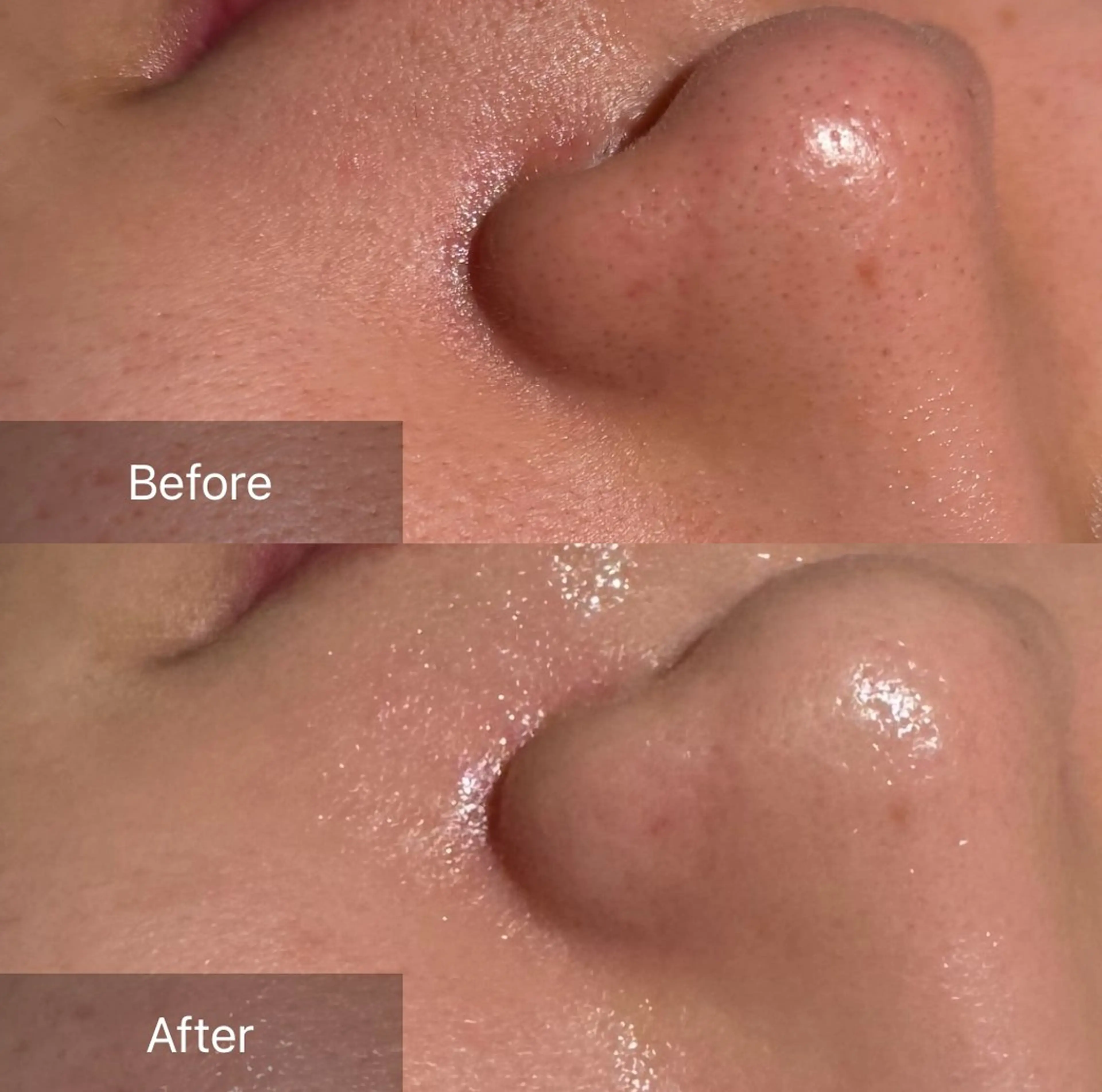 エステ for woman所属・森 美優のエステ・リラクイメージ