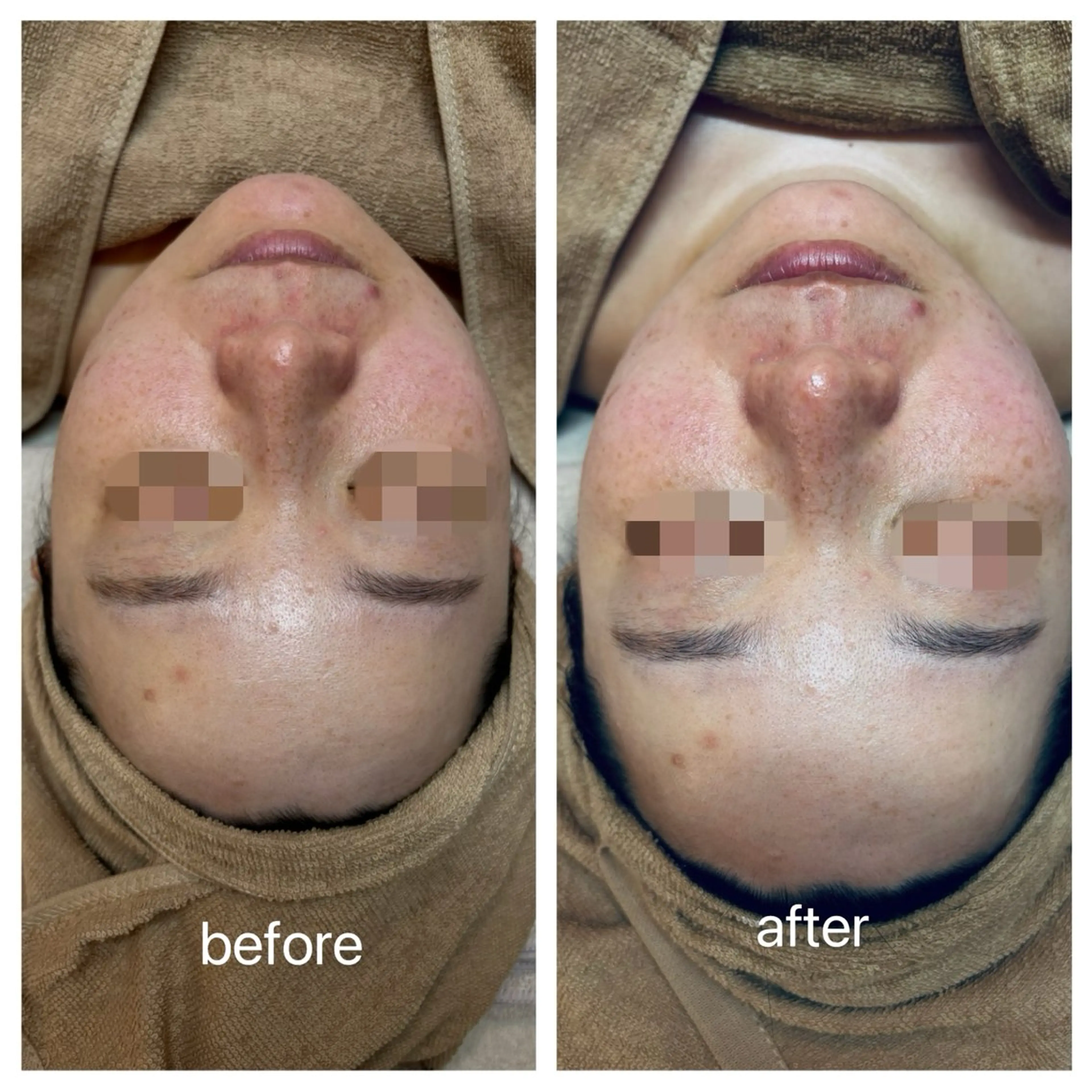 エステ 肌質改善フェイシャルCLEAR栄生/リンパ/毛穴/シミケア所属・井戸 麻衣のエステ・リラクイメージ