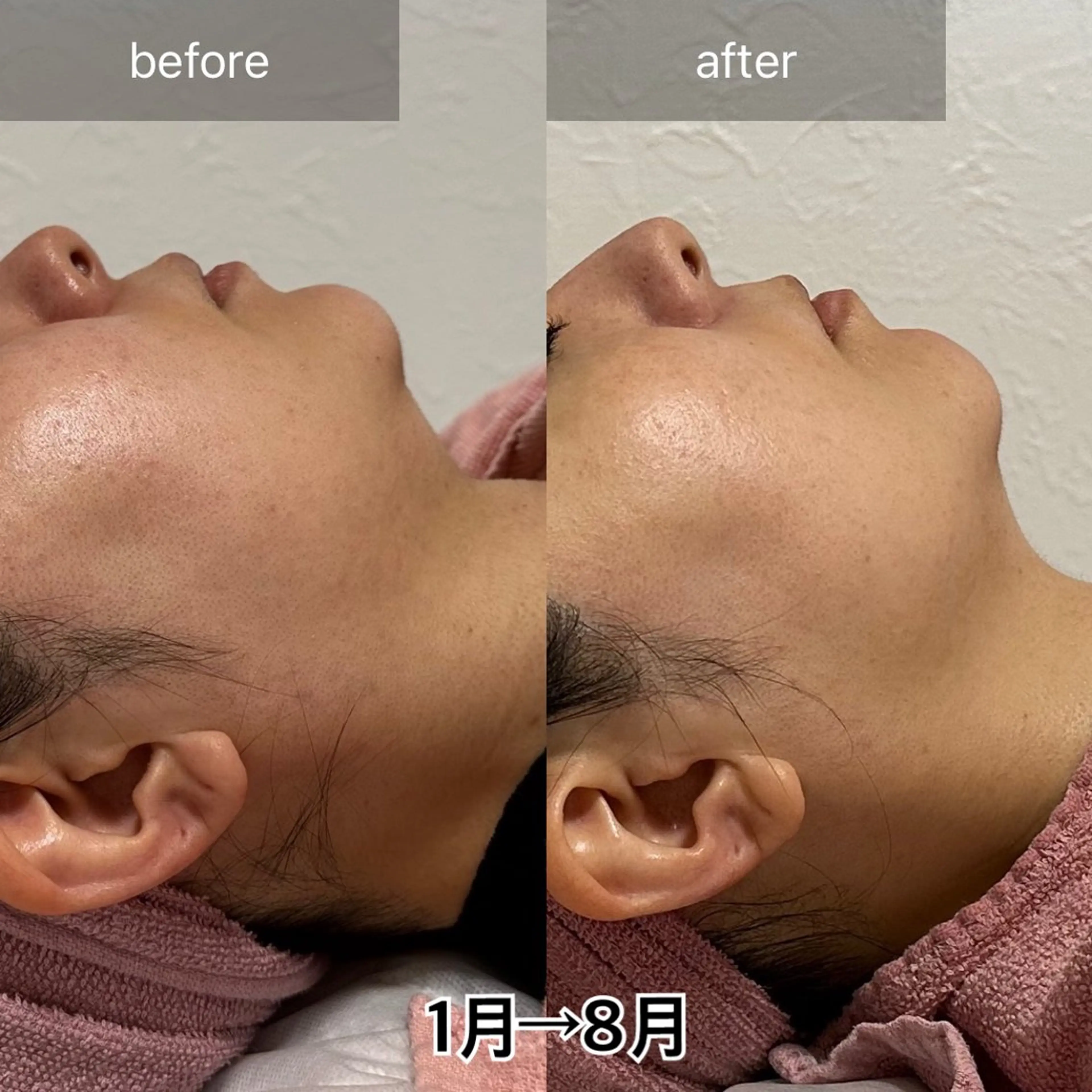 ALIA Scintiller  アリアサンティエ所属・齋藤 祐里耶のエステ・リラクイメージ