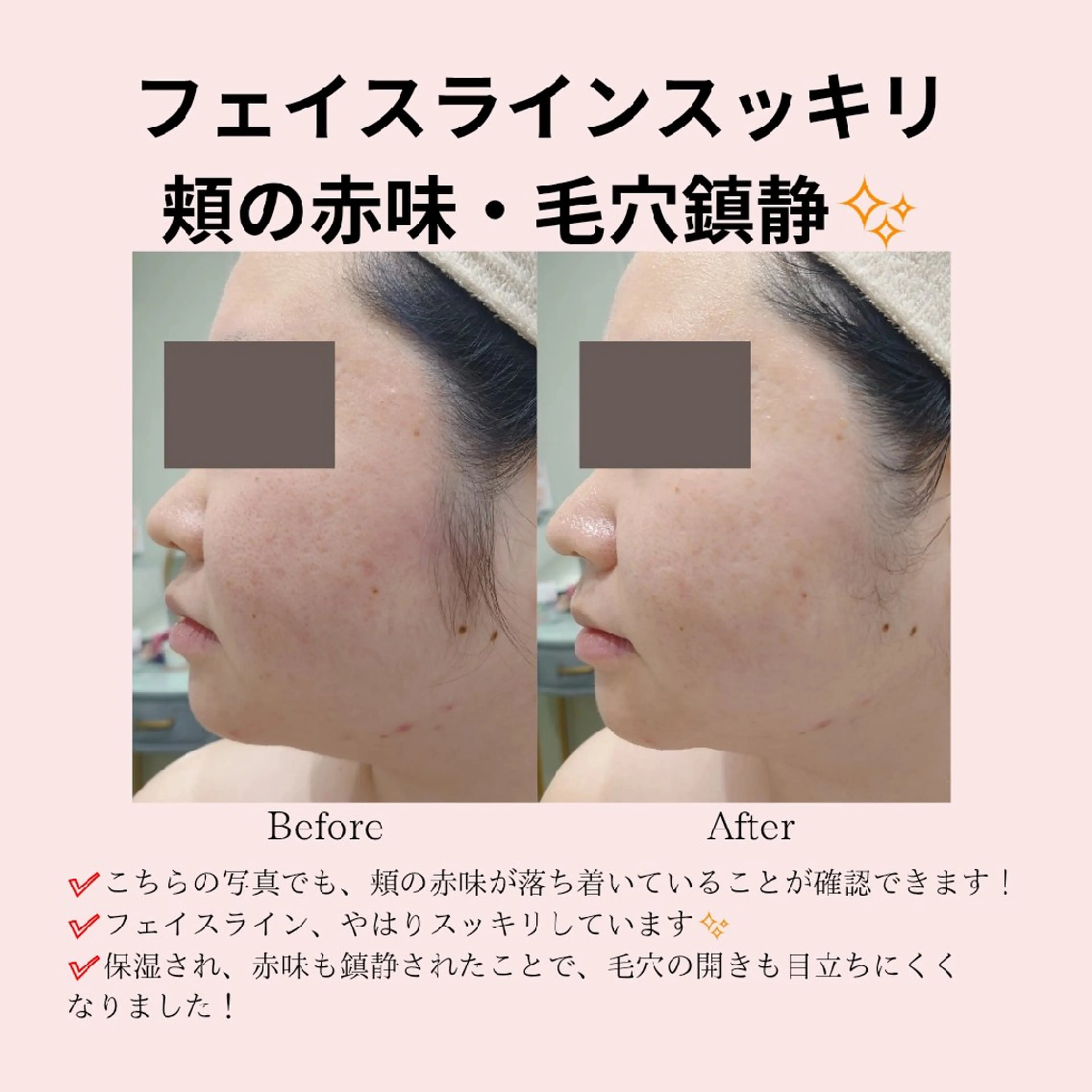 エステ PRETTIEST SHINE所属・山田 浩子のエステ・リラクイメージ