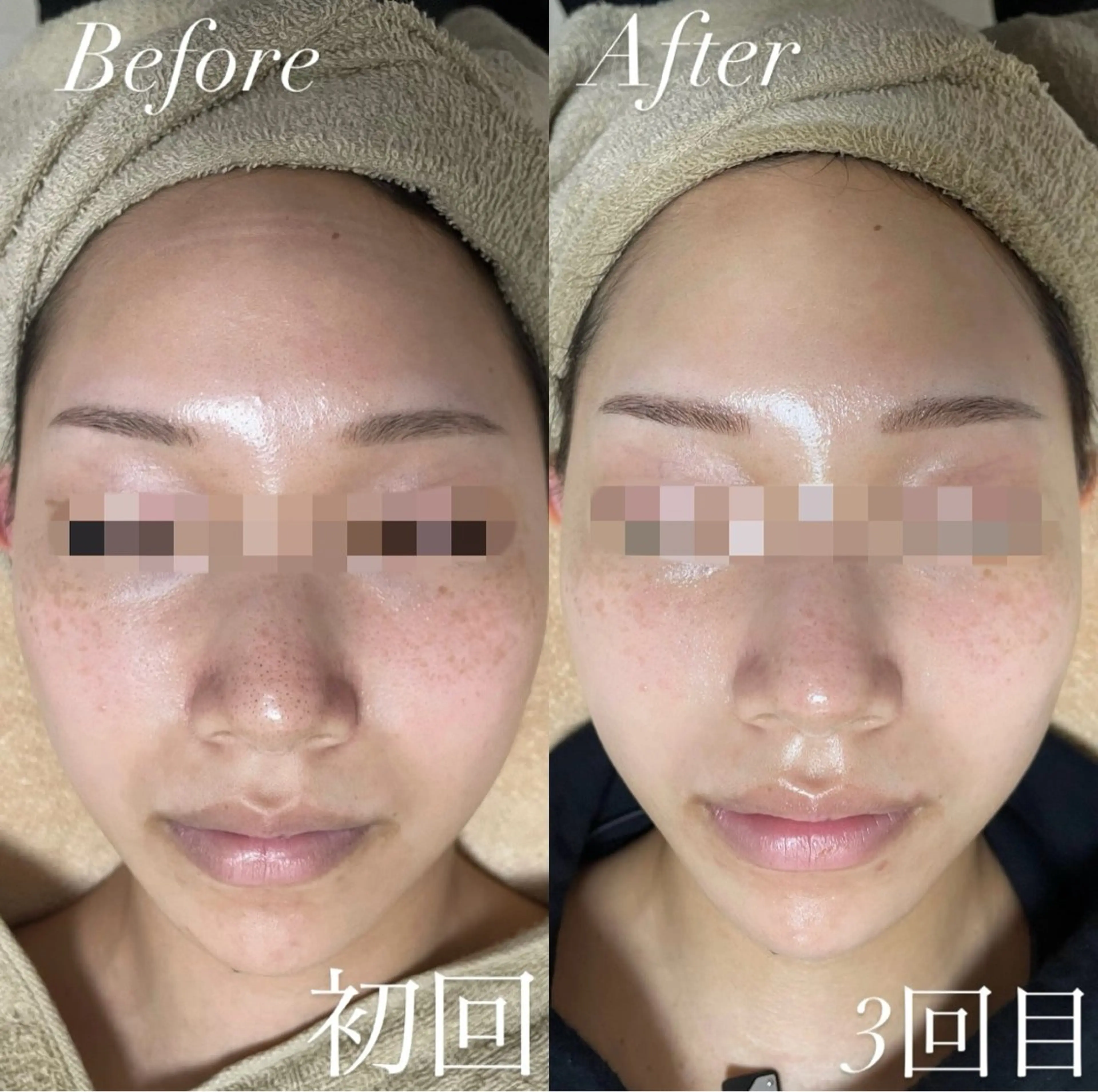 プライベートサロン Belle（ベル）のエステ・リラクイメージ