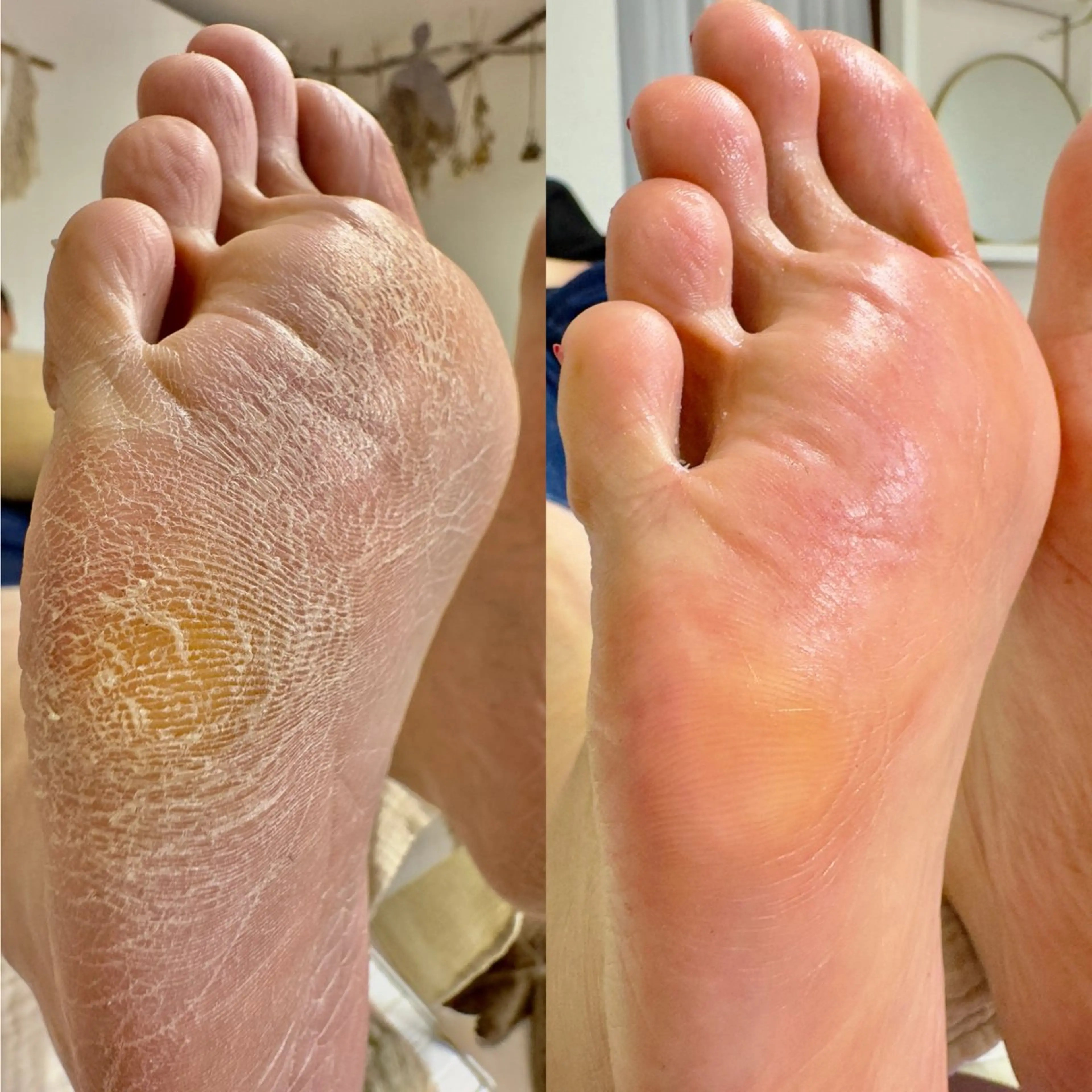 足裏角質ケア➕フットジェルの写真