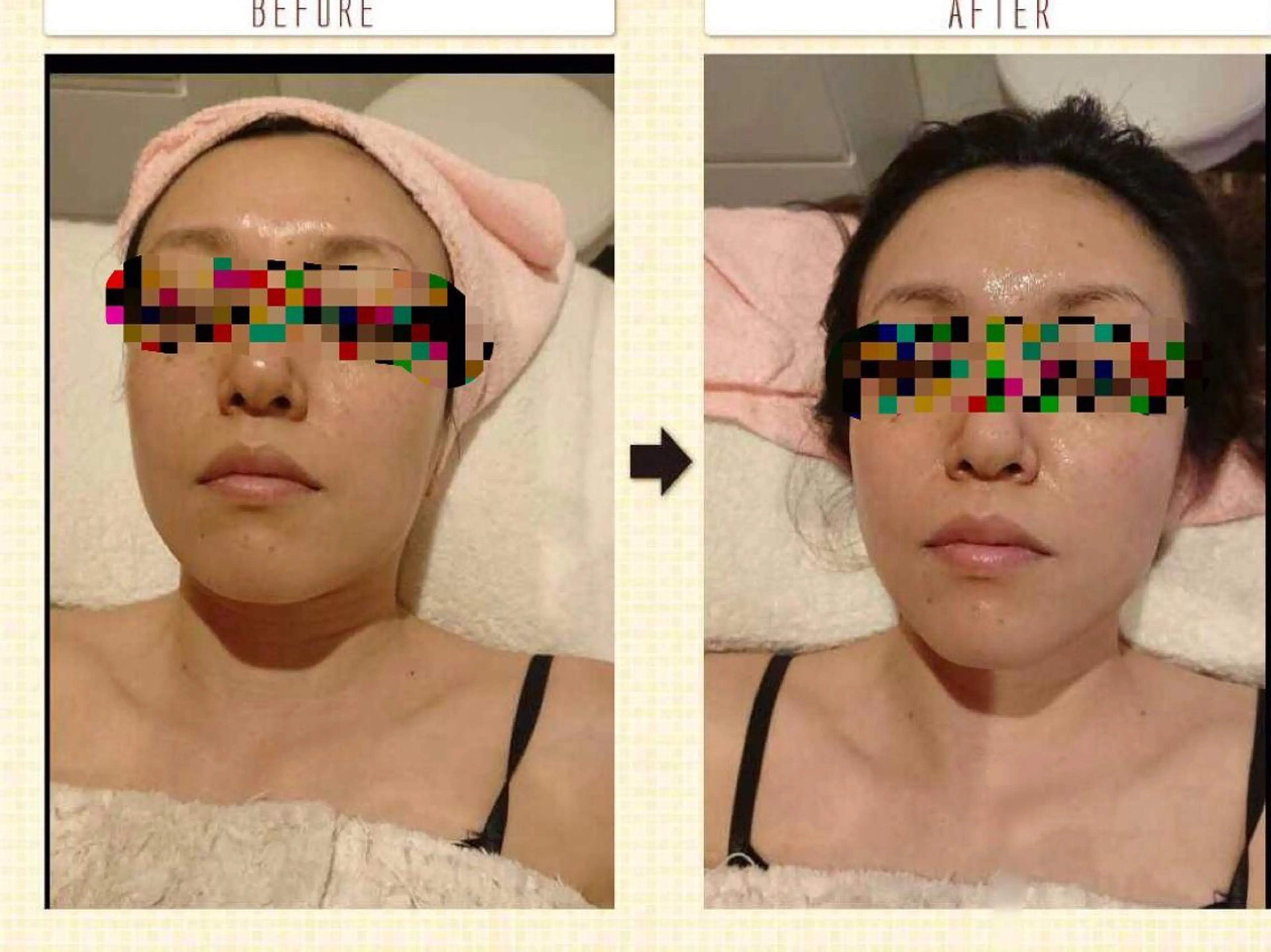 【リベルハーブピーリング認定店】敏感肌・美白脱毛専門店Dione立川店所属・Dione 立川店のエステ・リラクイメージ