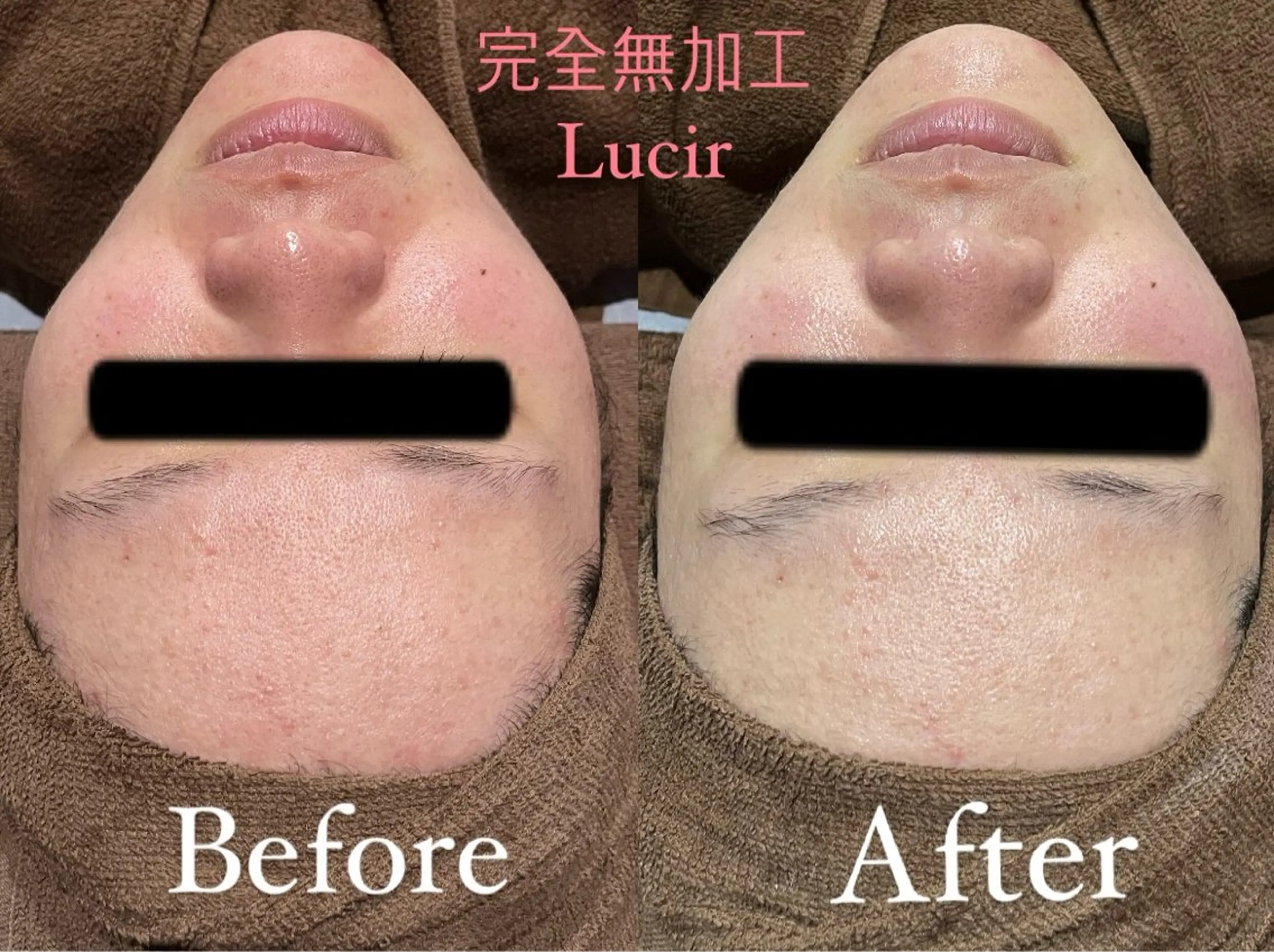 ルシール所属・脱毛＆小顔コルギ 専門店 Lucirのエステ・リラクイメージ