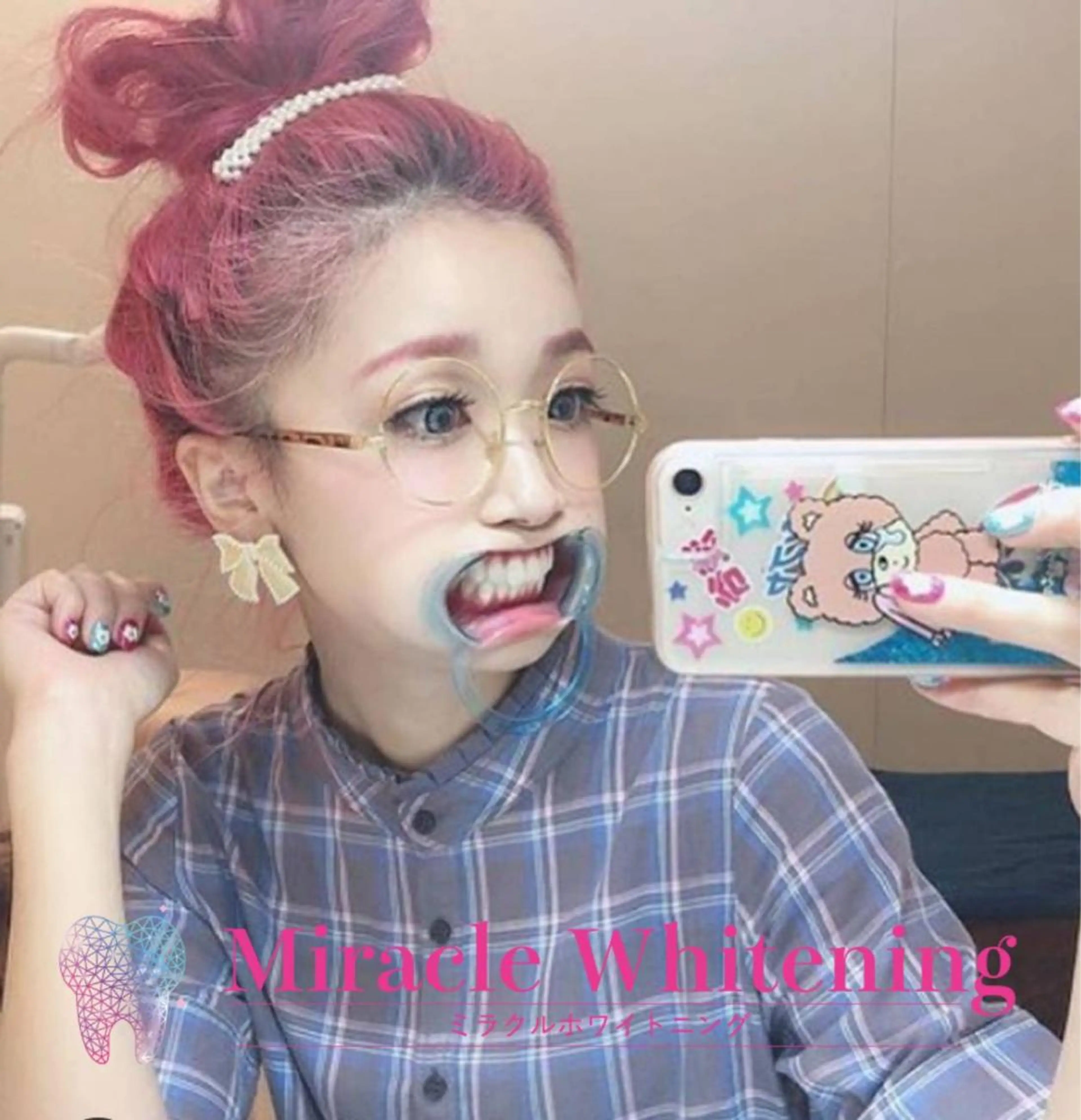 🐥初回限定🐥ハイパーミラクルホワイトニング✨🦷✨【16分✖️2照射】or【8分✖️4照射】歯の状態で選びます✨の写真