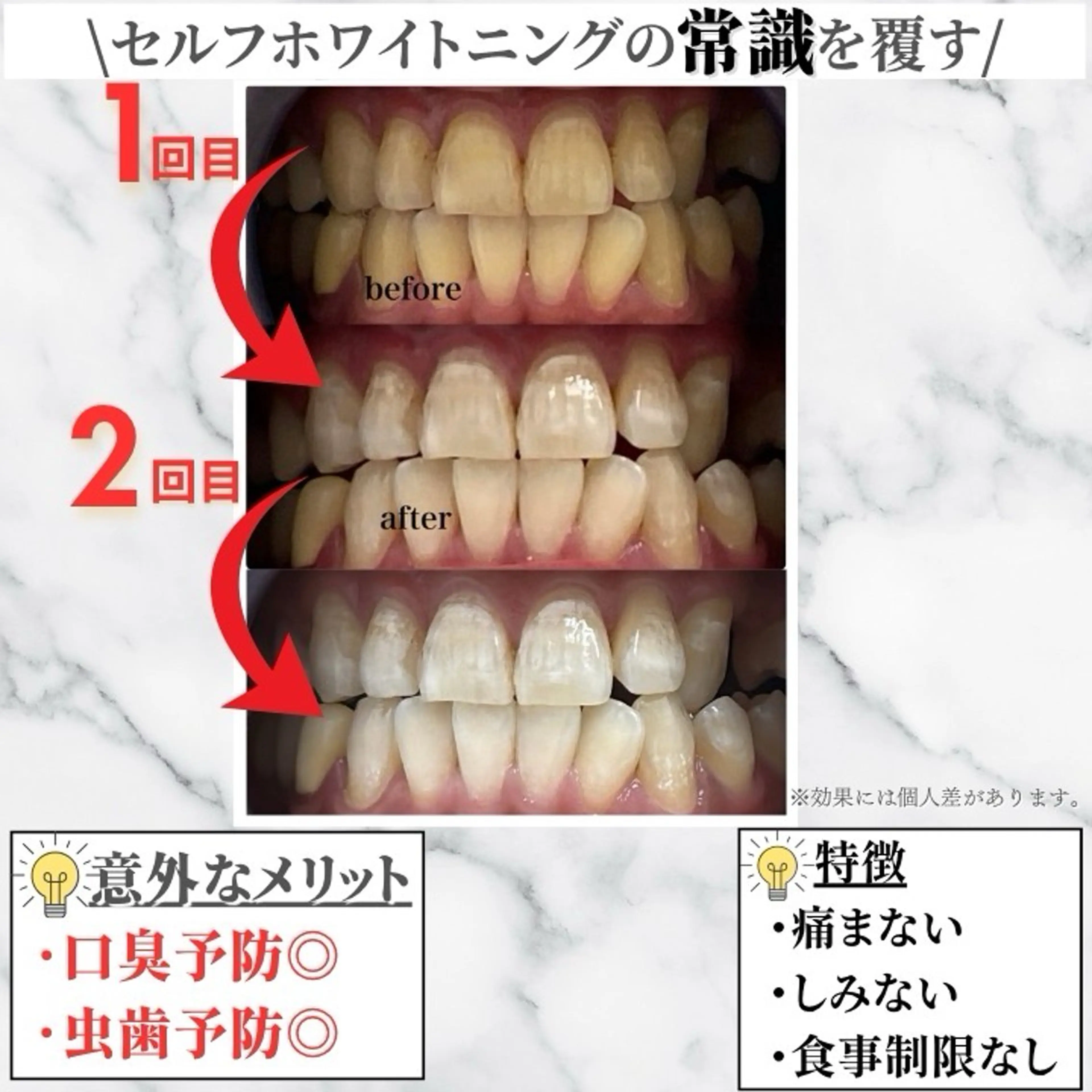 【1回分無料♪】最速で黄ばみ改善目指したい方にオススメ💡2回ご来店プラン♪¥13960→¥6980の写真