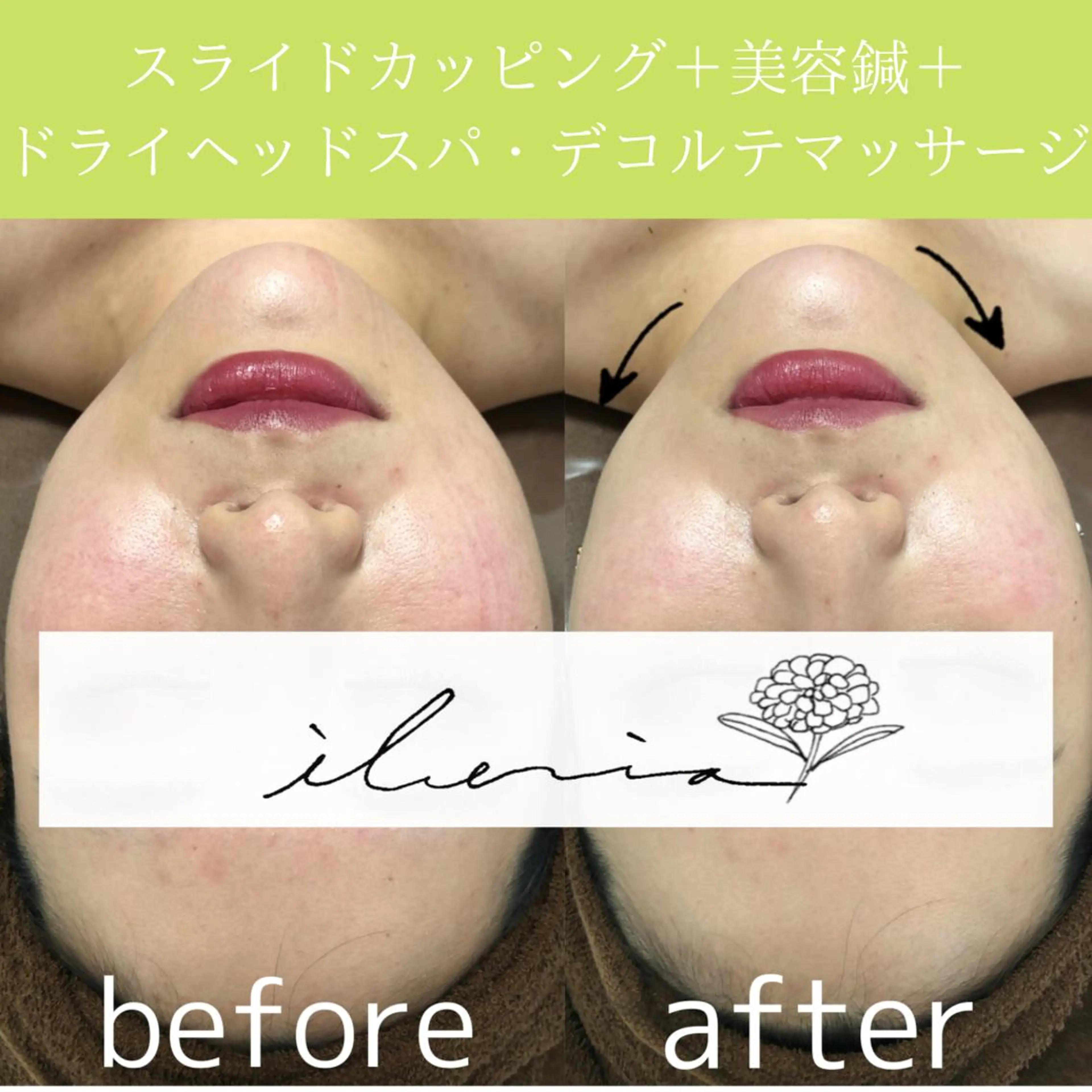 心斎橋痩身ダイエット 韓国.美容鍼.小顔のエステ・リラクイメージ