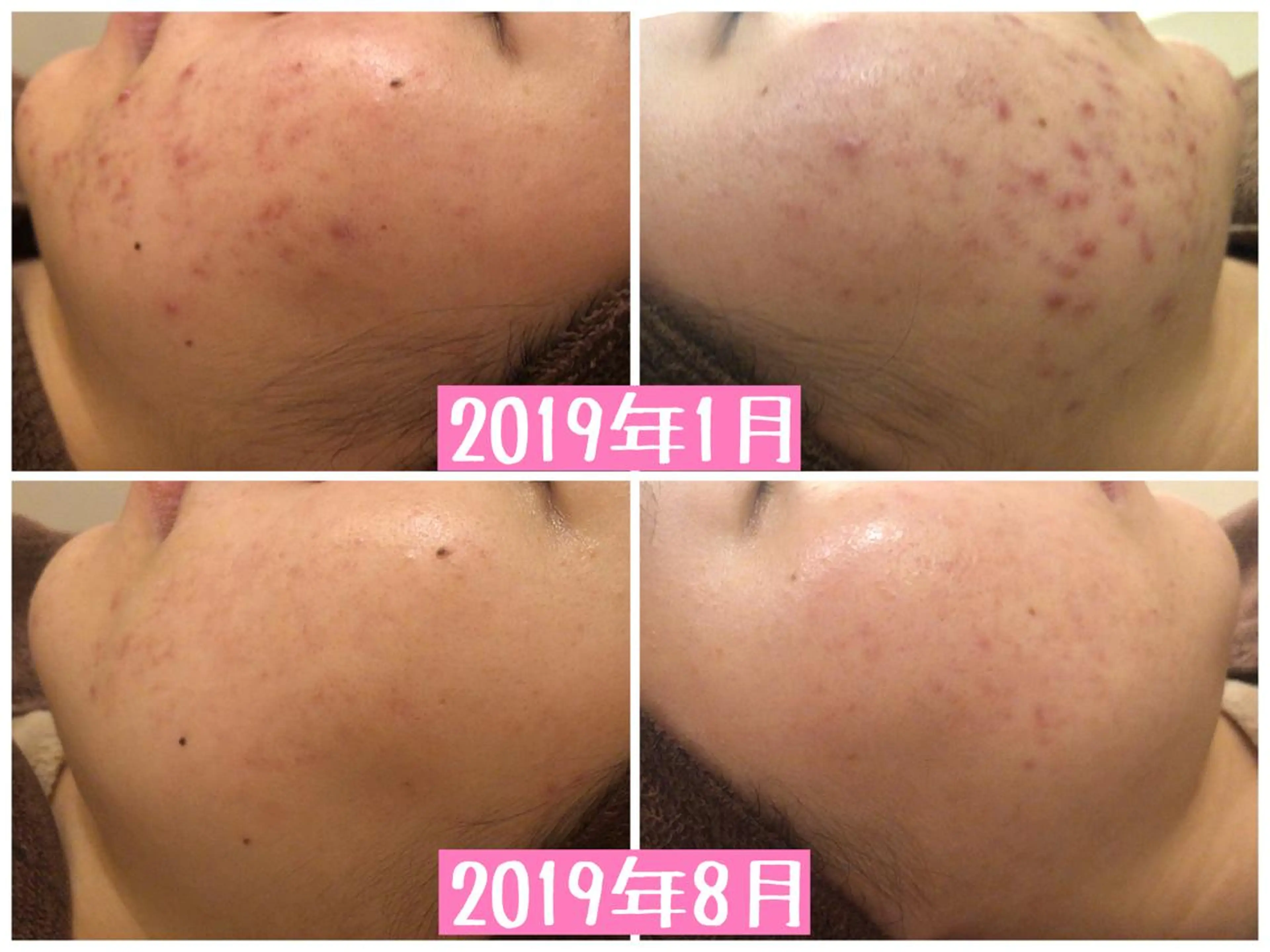 ショート カラー パーマ ヘアアレンジ メンズ キッズ ネイル マツエク・マツパ エステ リラク ニキビ・肌質改善専門 ♡人生が変わるサロンのエステ・リラクイメージ