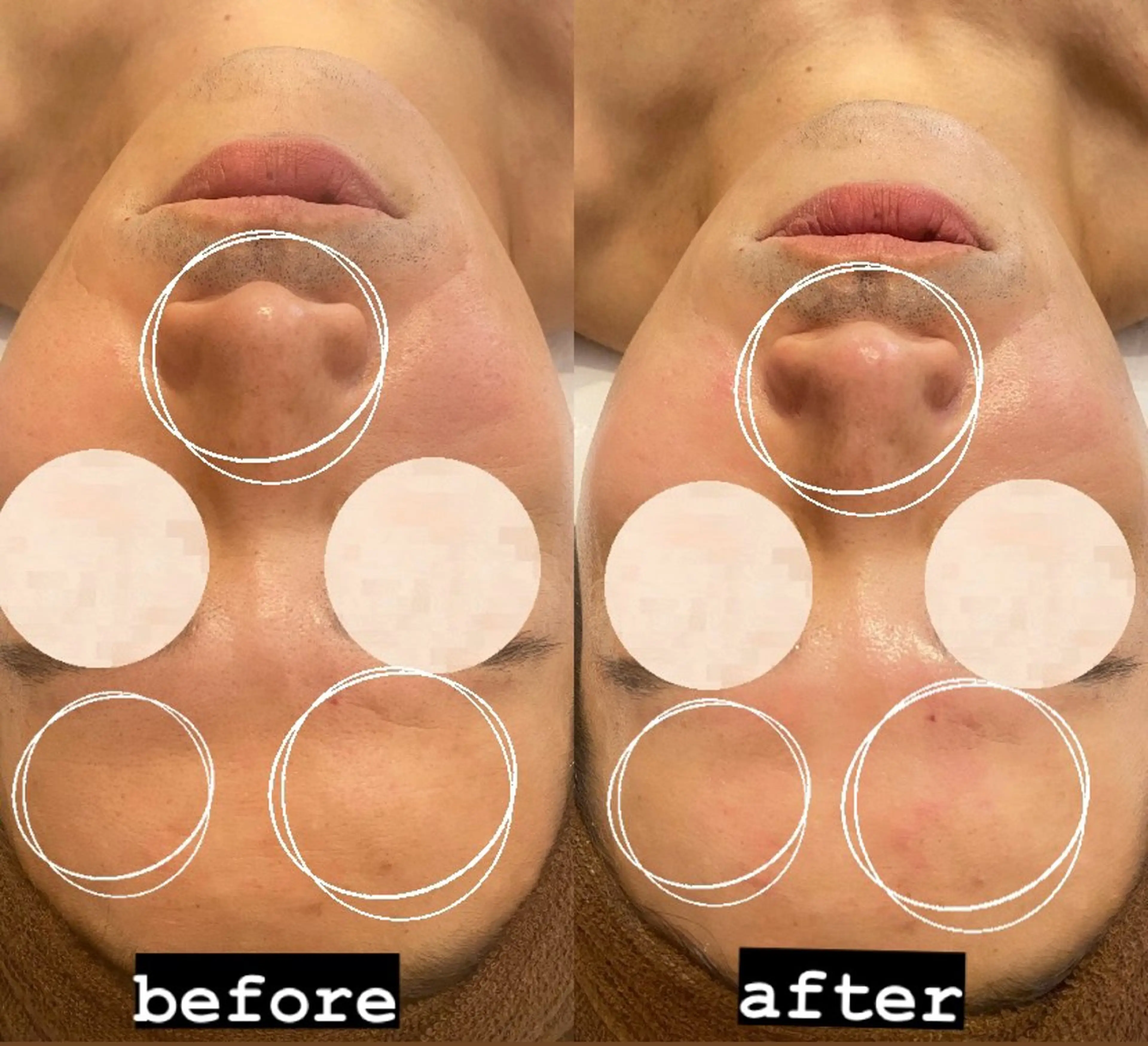 クレアス勝どき・肌質改善専門店【CREAS Beauty Salon】所属・クレアス勝どき【毛穴 ハーブピーリング専門のエステ・リラクイメージ