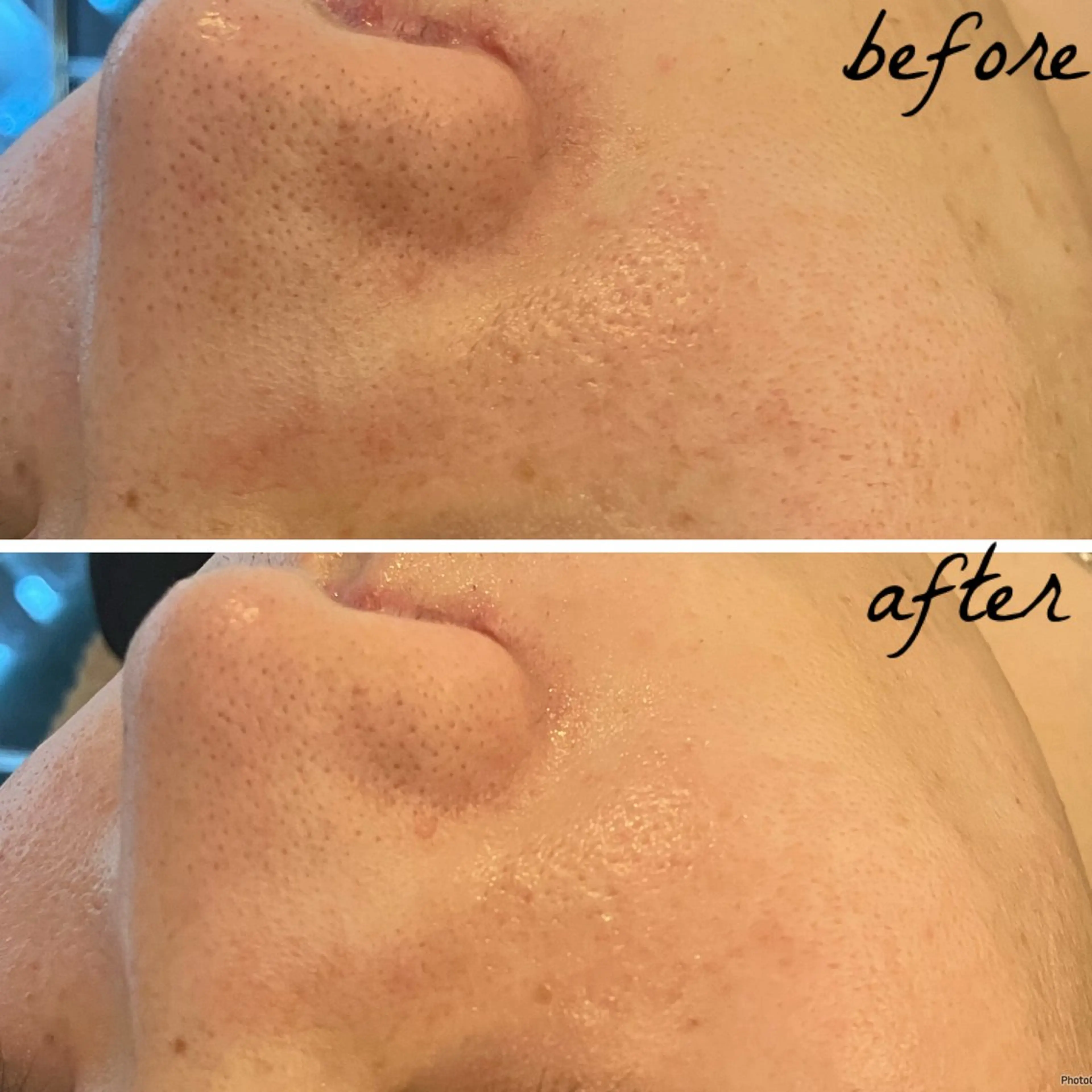 メンズ メナード岐阜茜部 杉浦のエステ・リラクイメージ