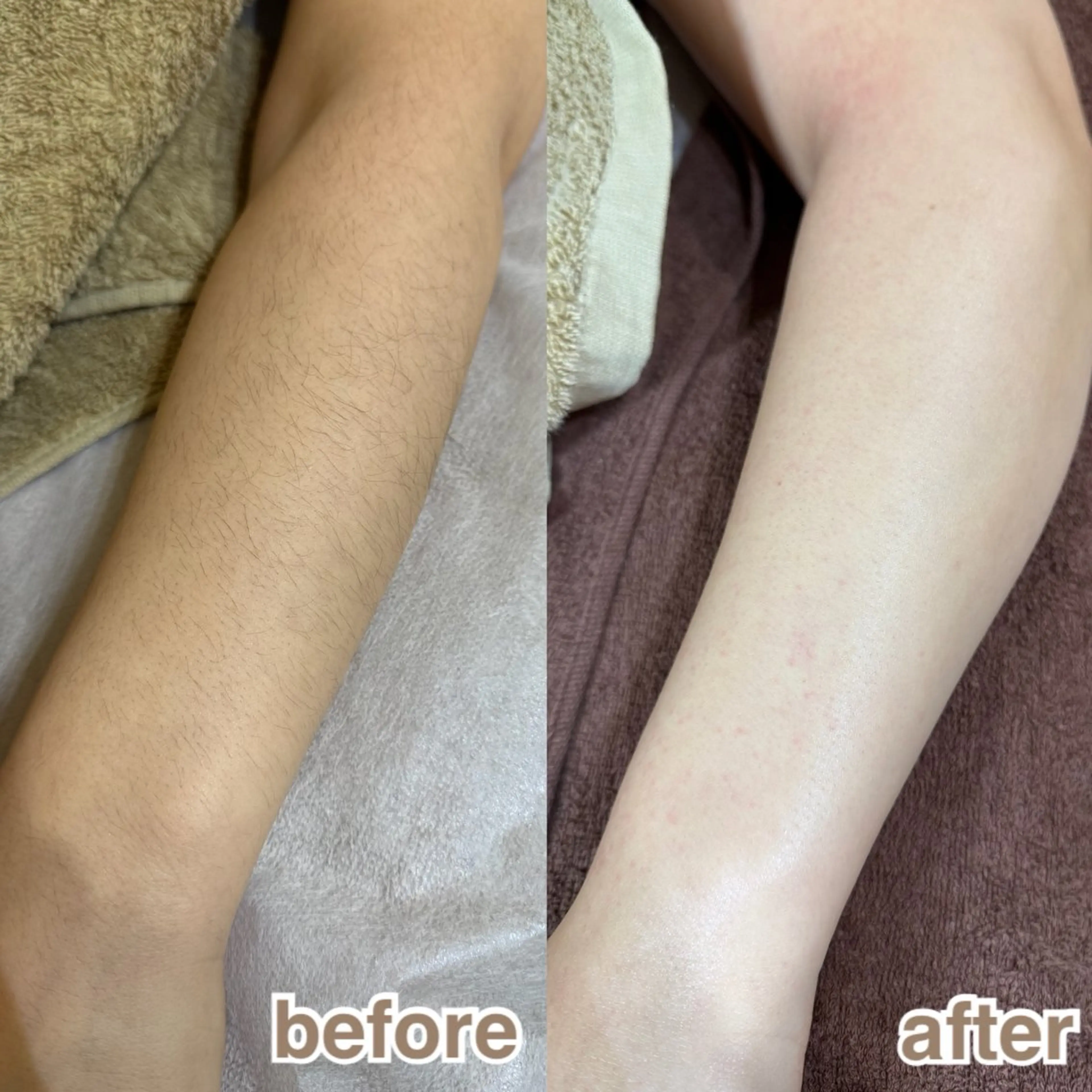 メンズ専用クーポン☆☆両腕ハーフワックスの写真