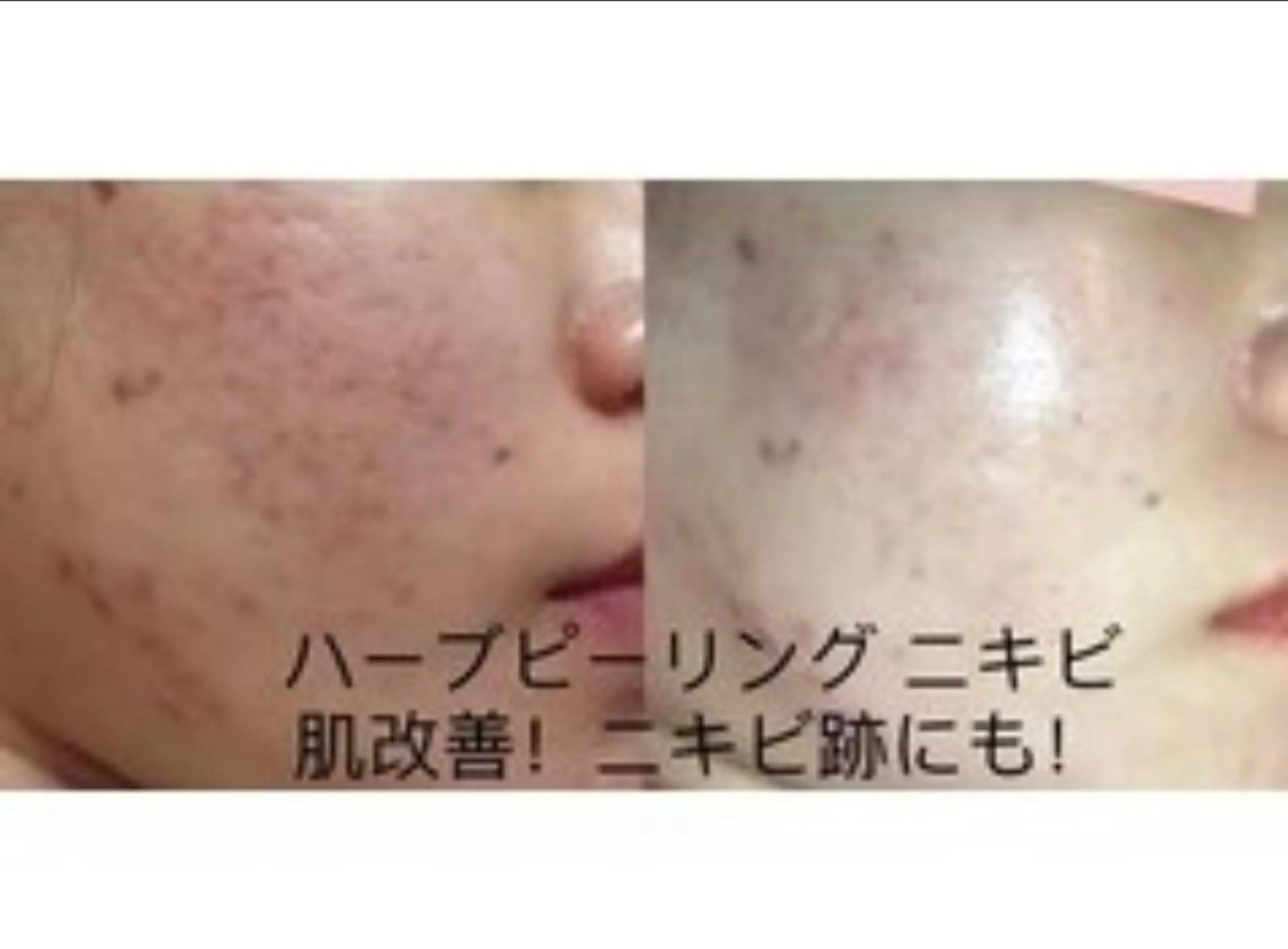 エステサロン ユミのエステ・リラクイメージ