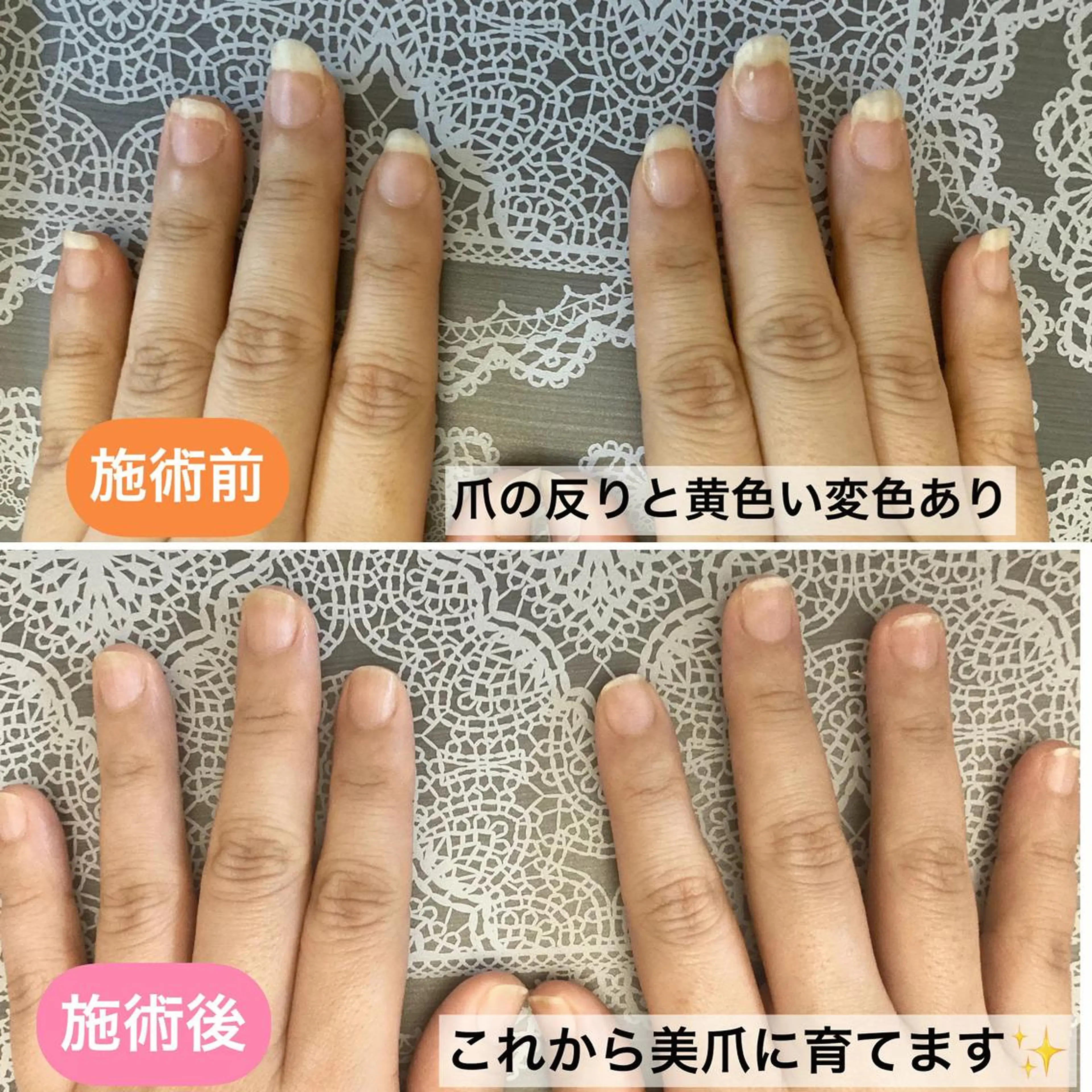 ネイル ジェルネイル スカルプネイル スクエアネイル 黄色 ハンドケア＆ネイルケア桃の木所属・ケアリスト🍀 マリユキのネイルデザイン