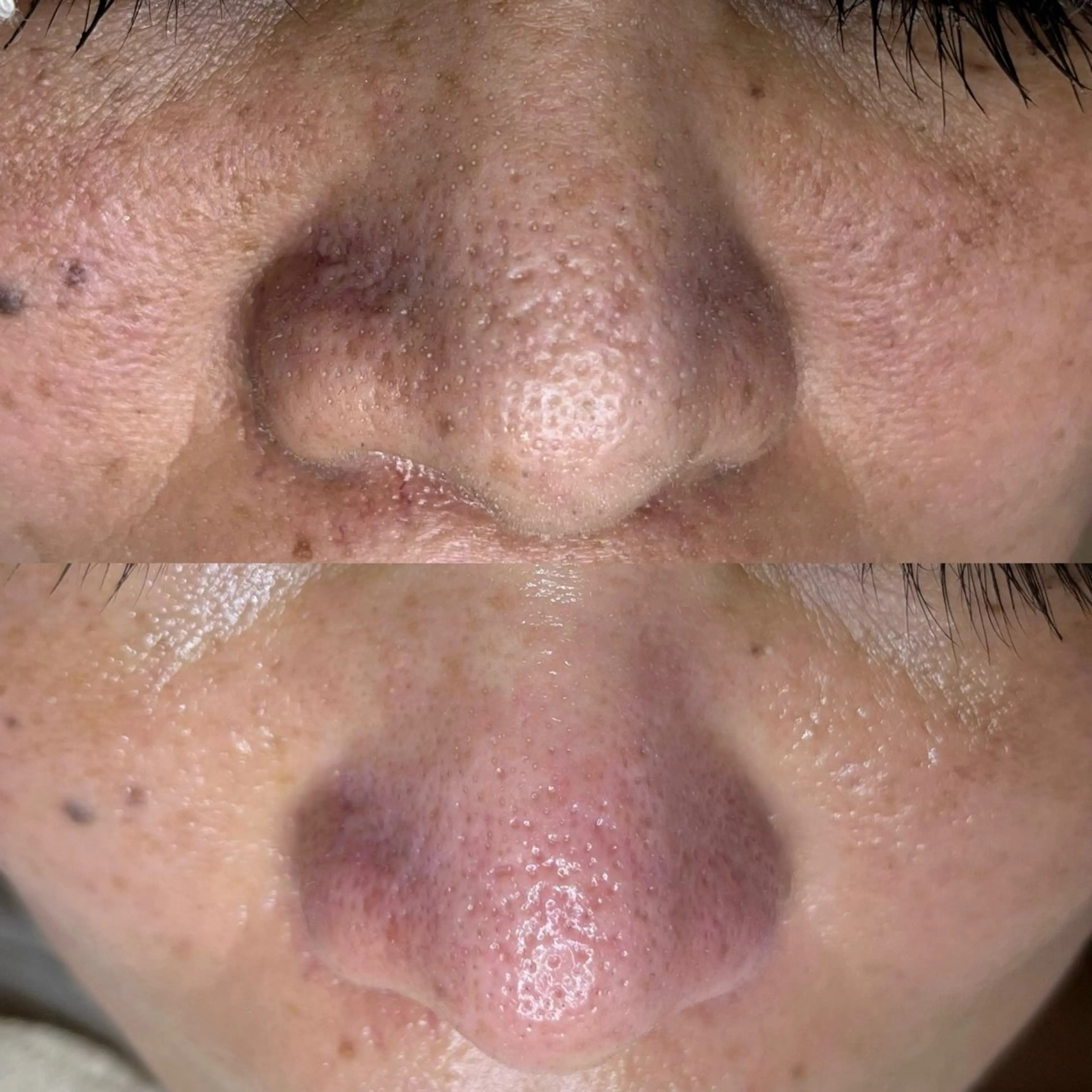 毛穴ケア・ヘッドスパサロンSHINY(シャイニー)所属・毛穴ケア・ヘッドスパ サロンSHINYのエステ・リラクイメージ