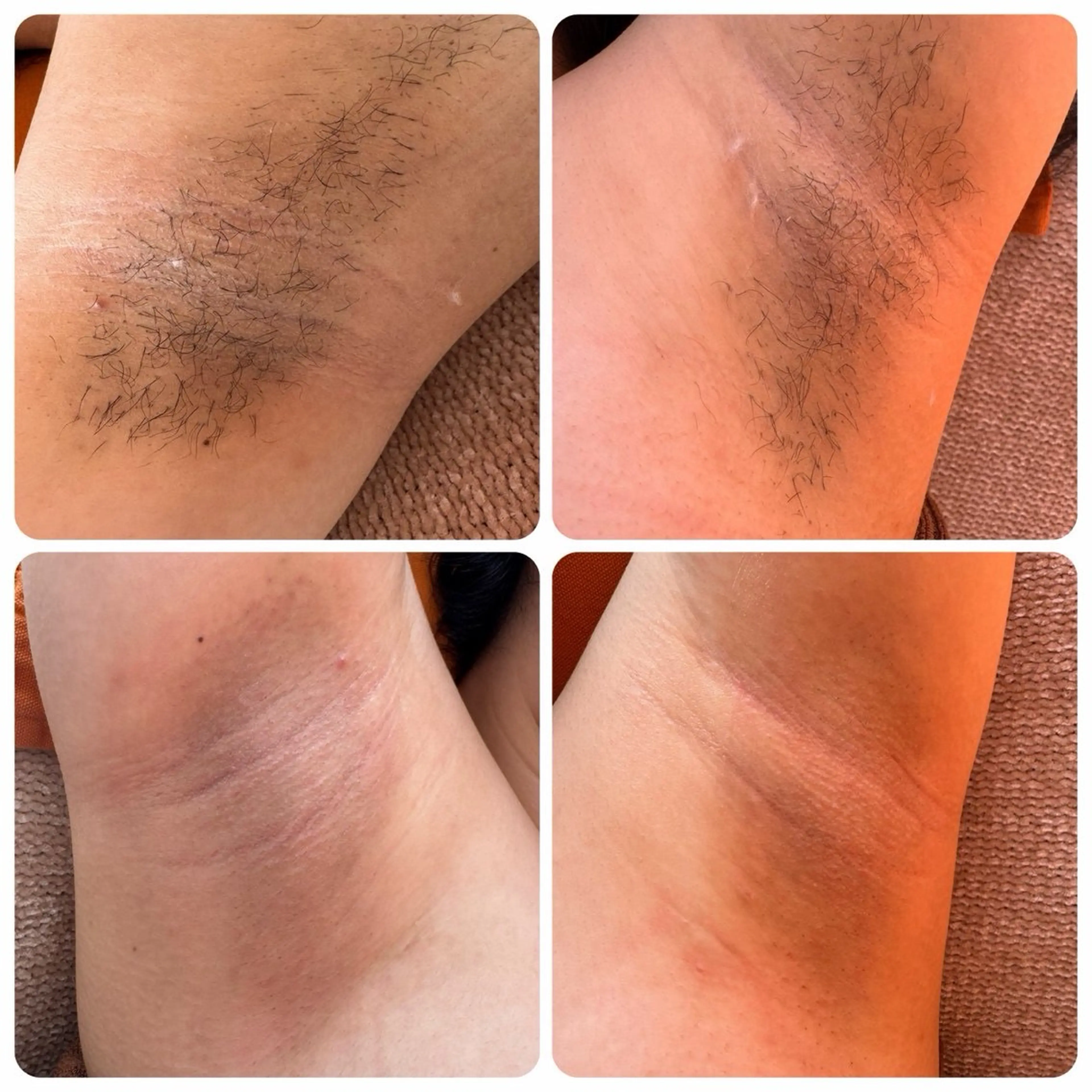 脱毛 Vonita Mikieのエステ・リラクイメージ