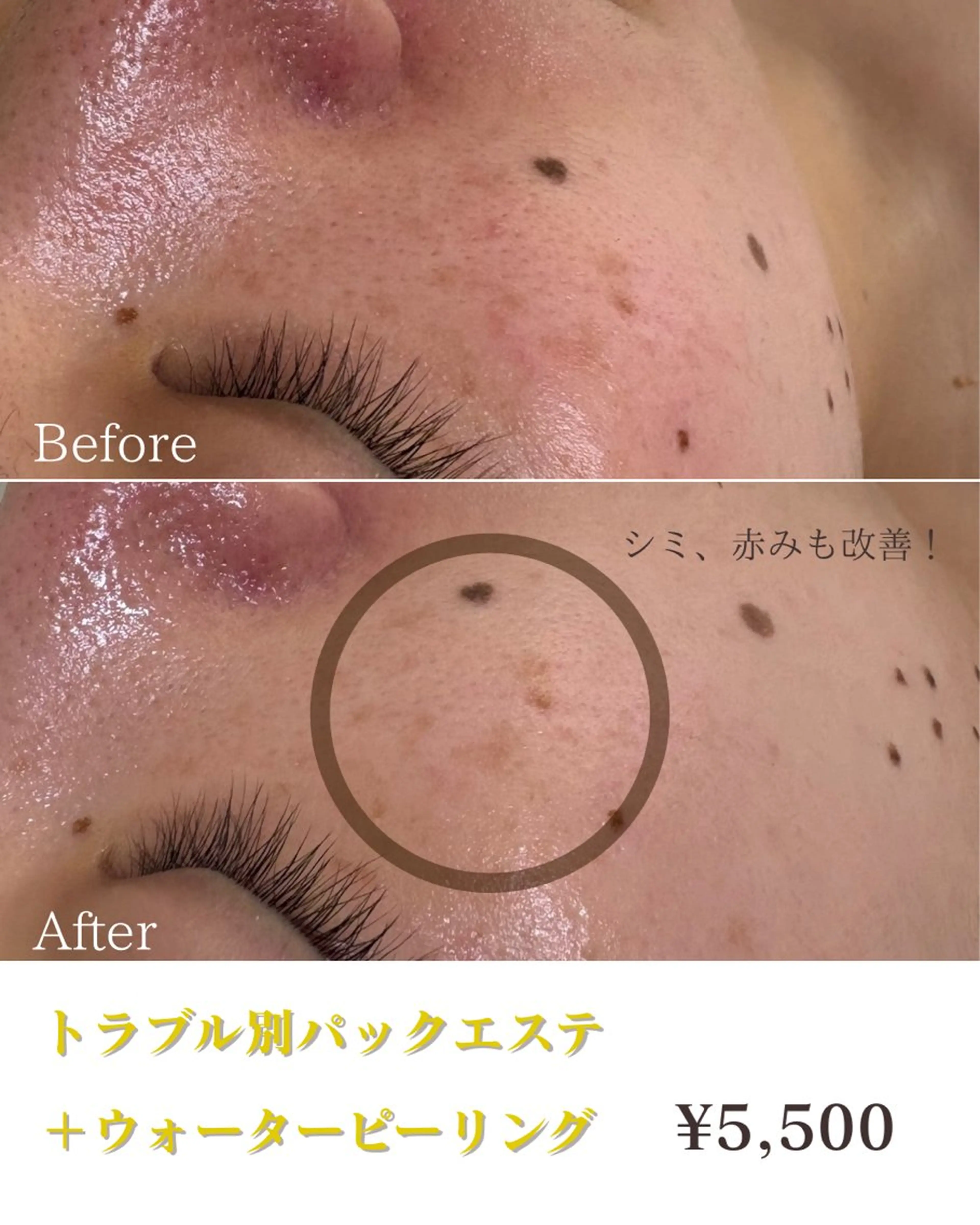 エステと焼き菓子 レモンバームソワンのエステ・リラクイメージ