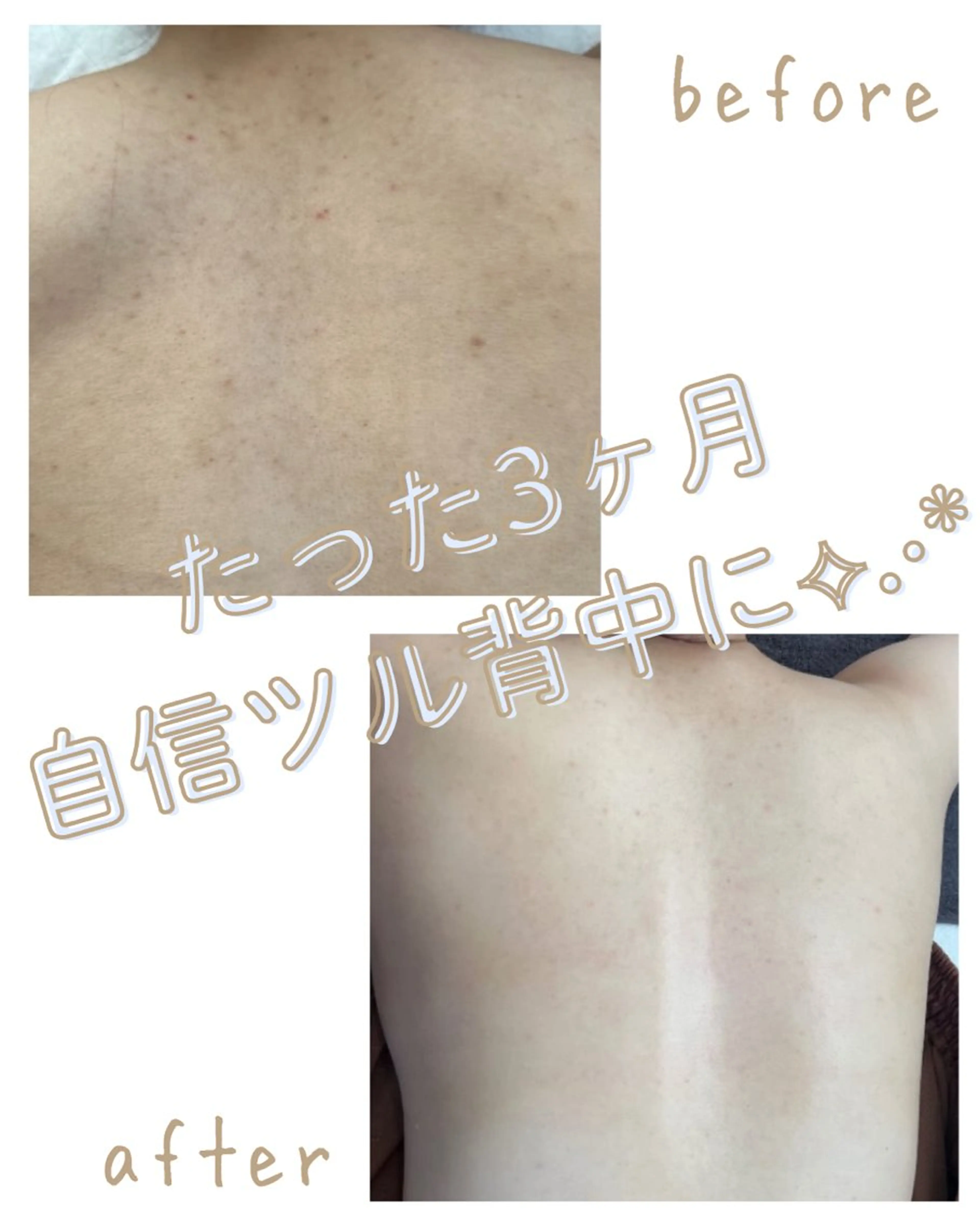 エステ miki 東根の肌質改善サロンのエステ・リラクイメージ