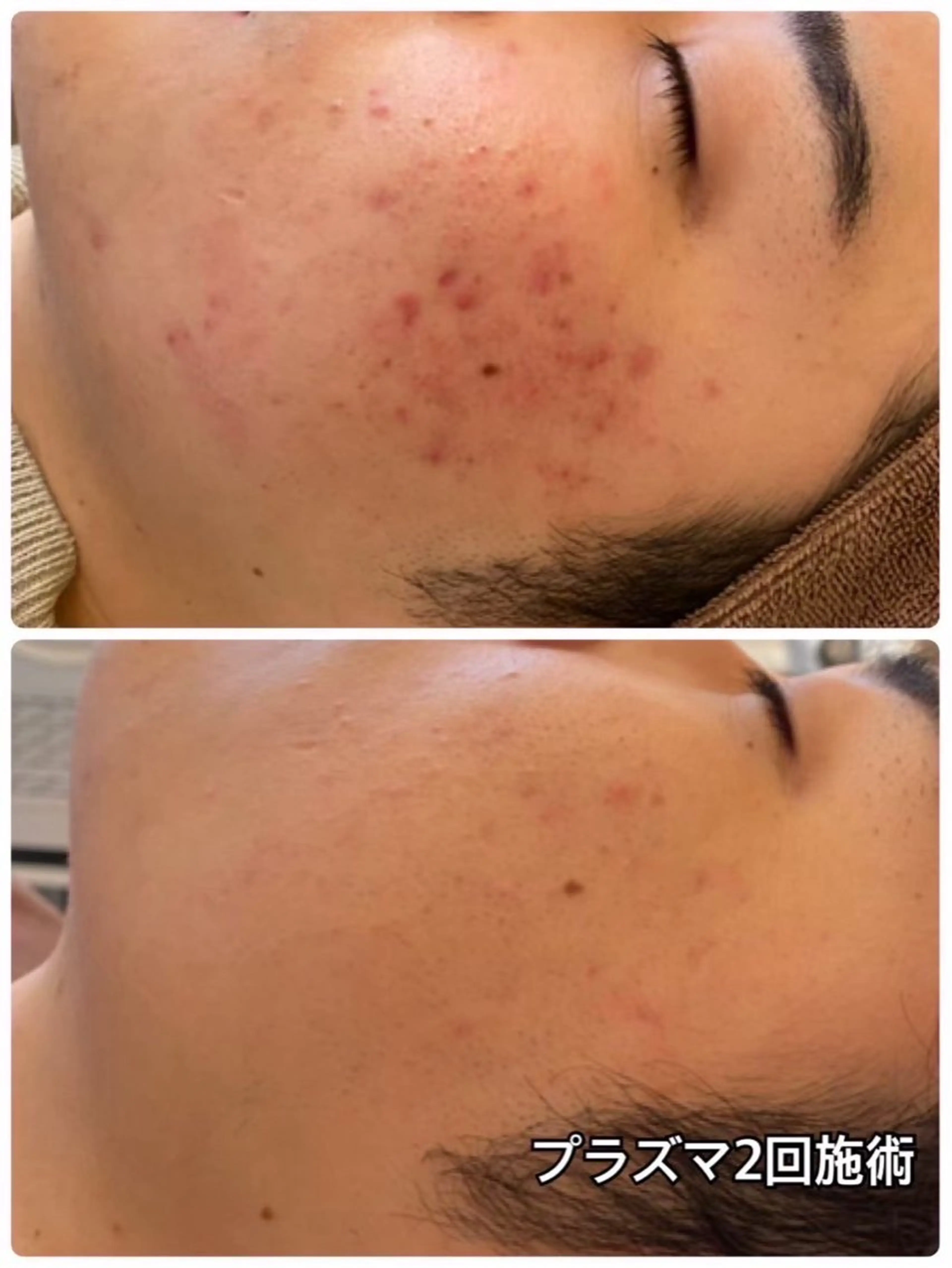 エステ EARTH coiffure beaute 小山店所属・EARTH 小山店 shimaのエステ・リラクイメージ