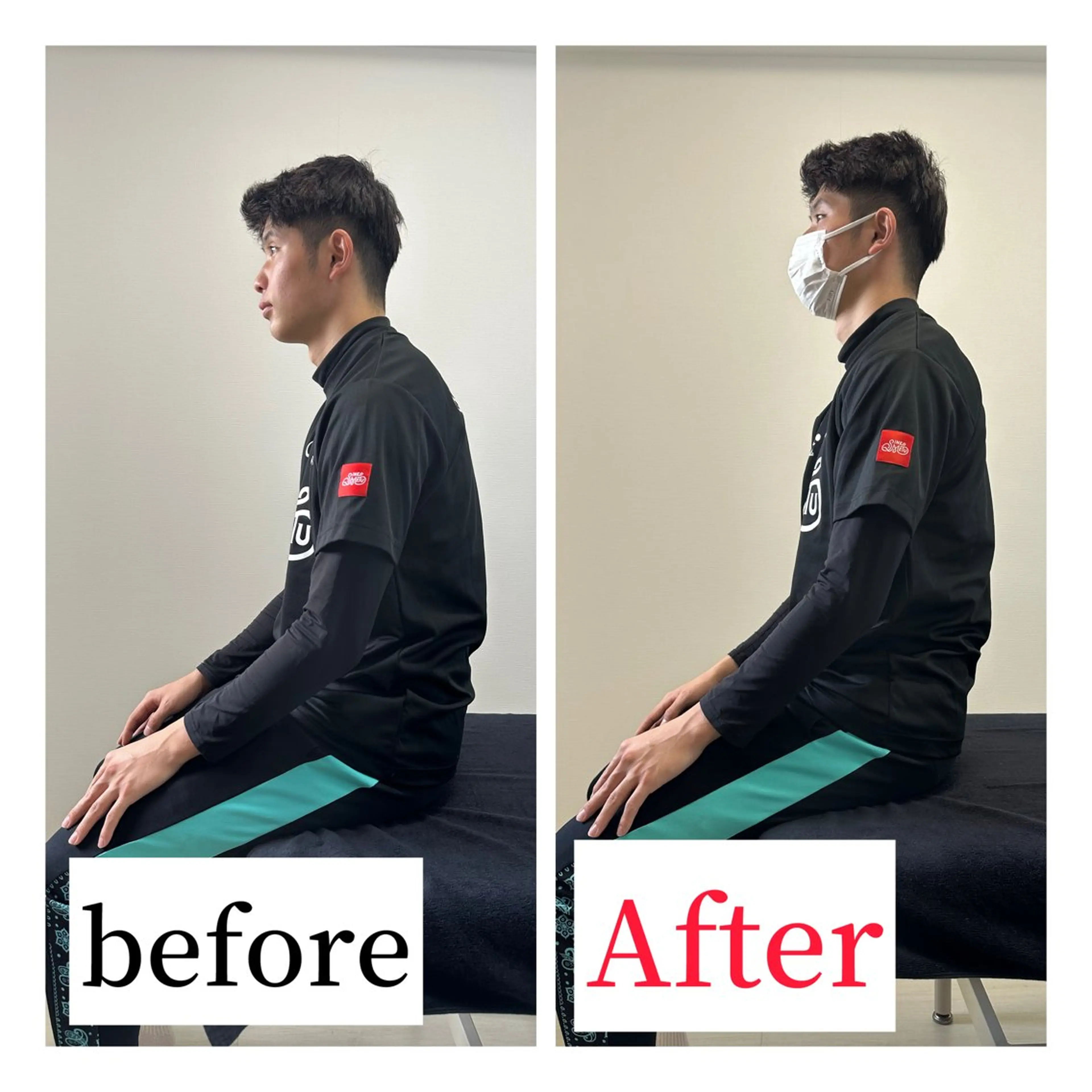 【猫背/巻き肩】デスクワークでの体の歪み改善‼️肩周りの矯正で華奢な身体に👯‍♀️姿勢が良くなると好印象🌈✌️の写真