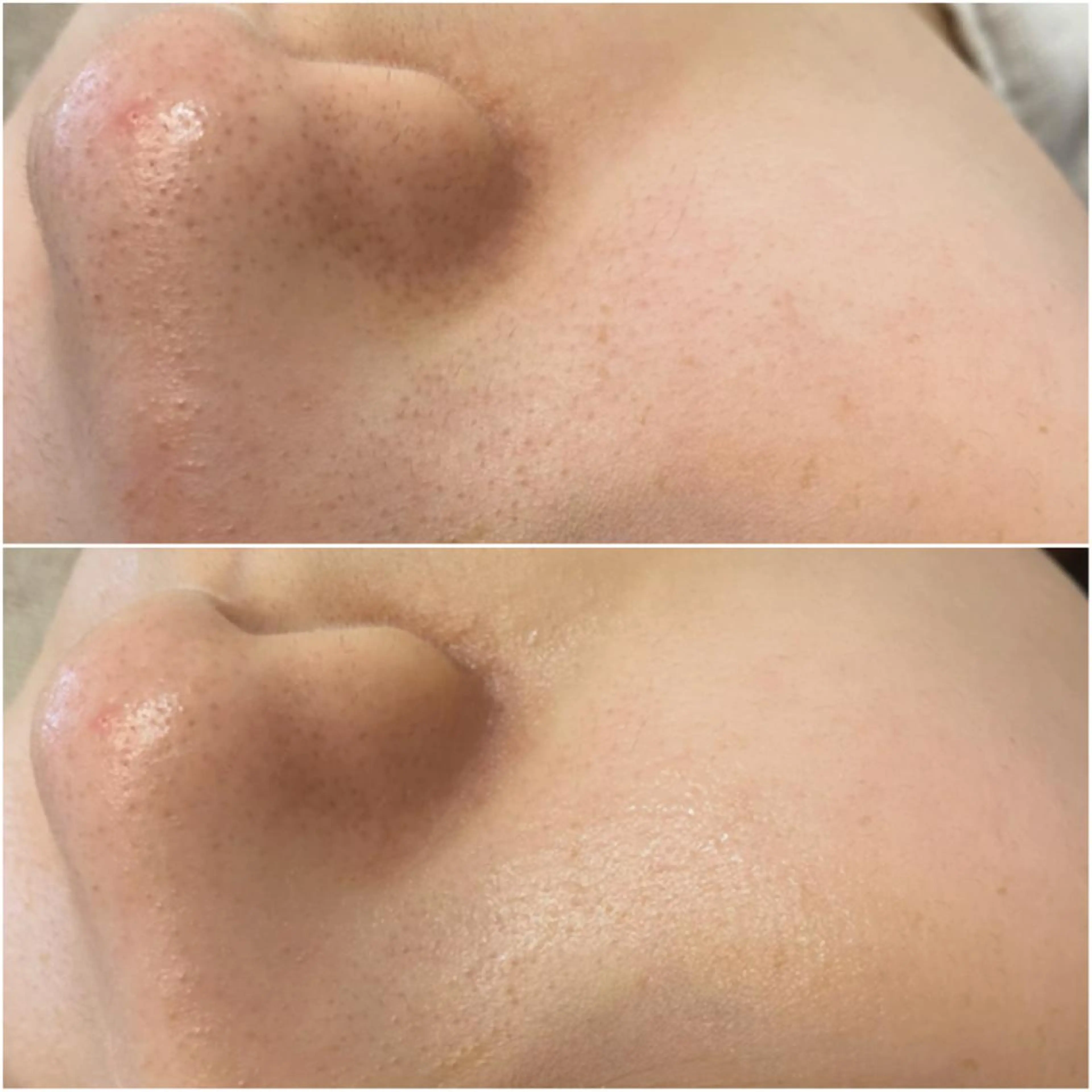 エステ ✨美肌水光✨ アトリエリュバンのエステ・リラクイメージ