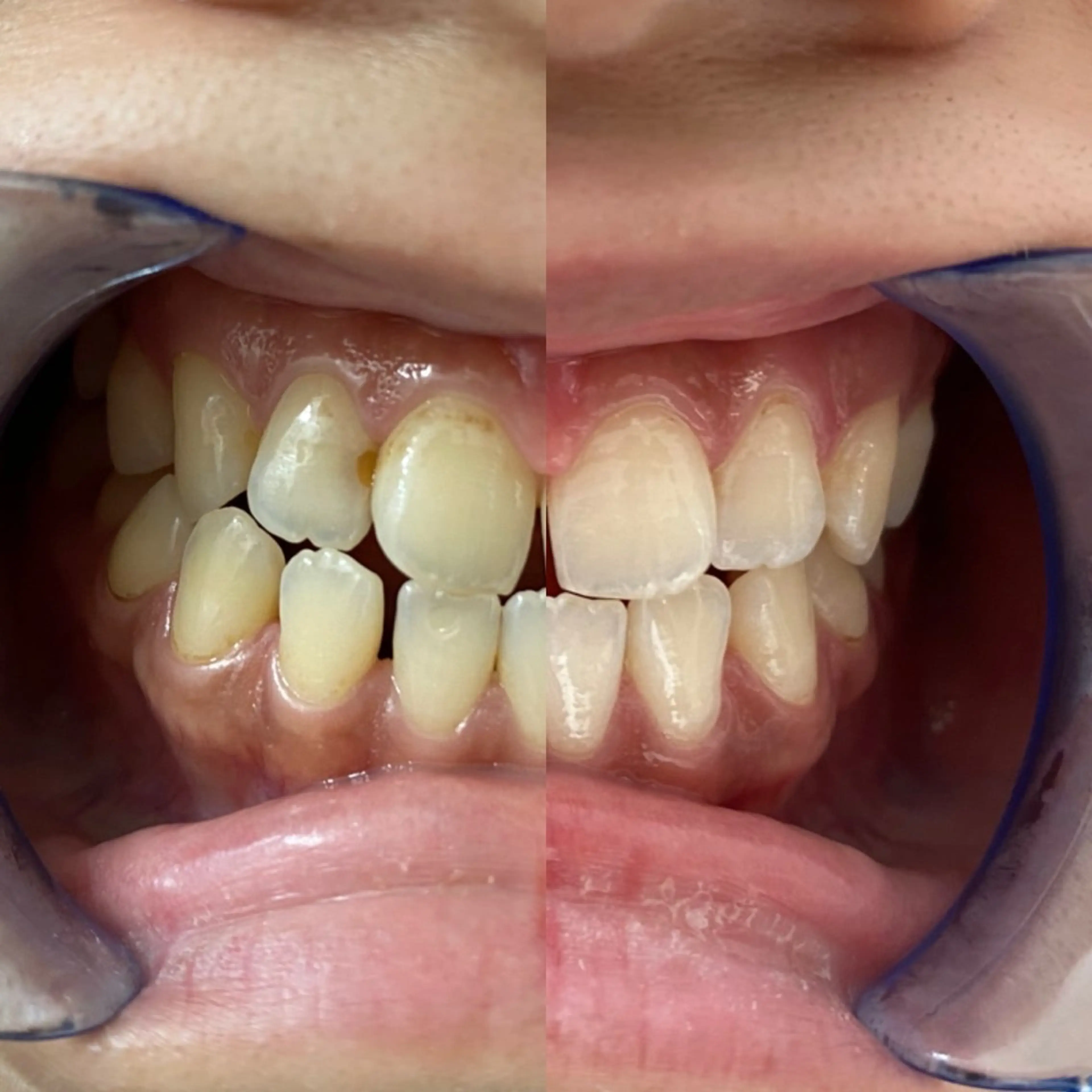 ホワイトニングサロン EARTH福岡姪浜店のその他イメージ