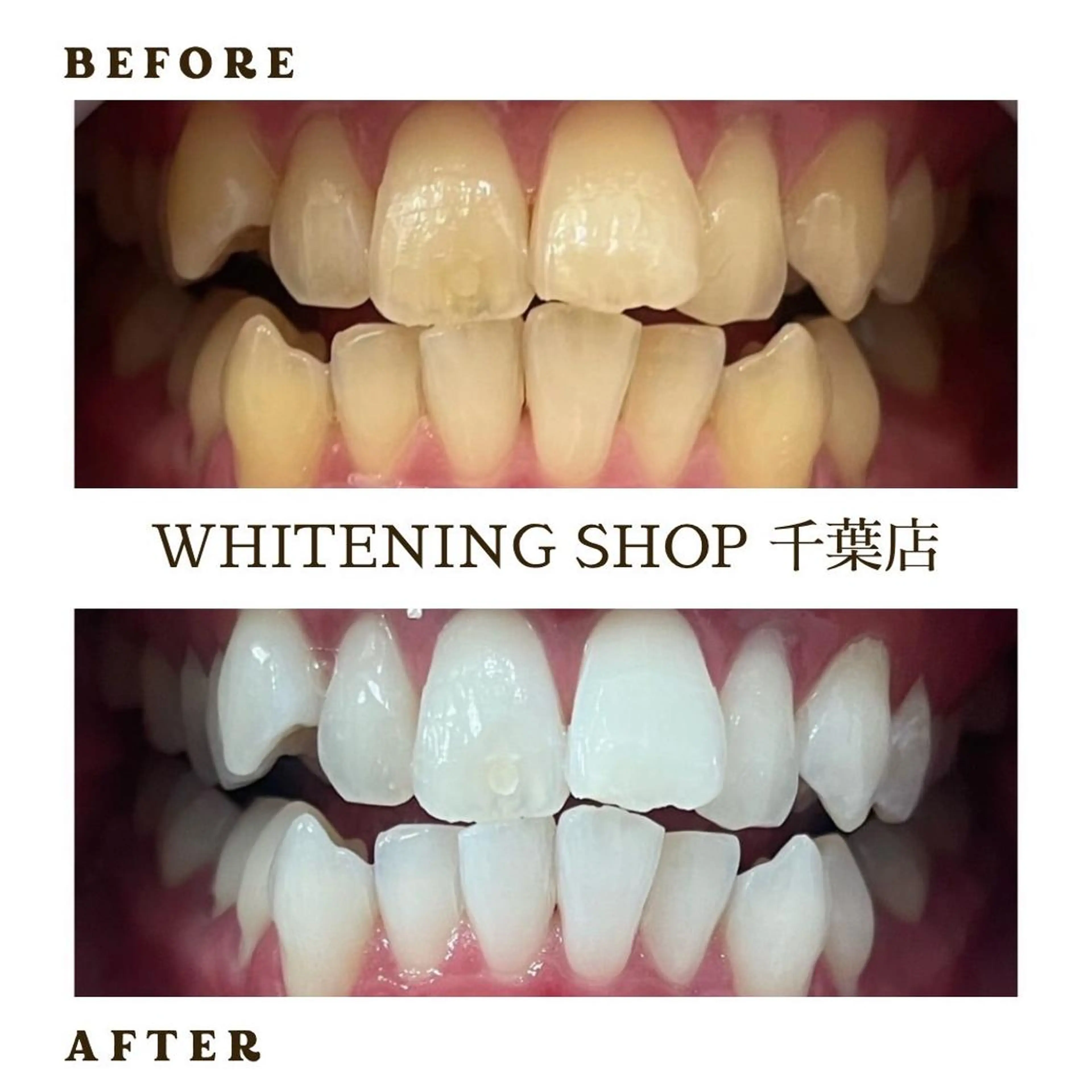 メンズ エステ ホワイトニング ショップ千葉店のその他イメージ