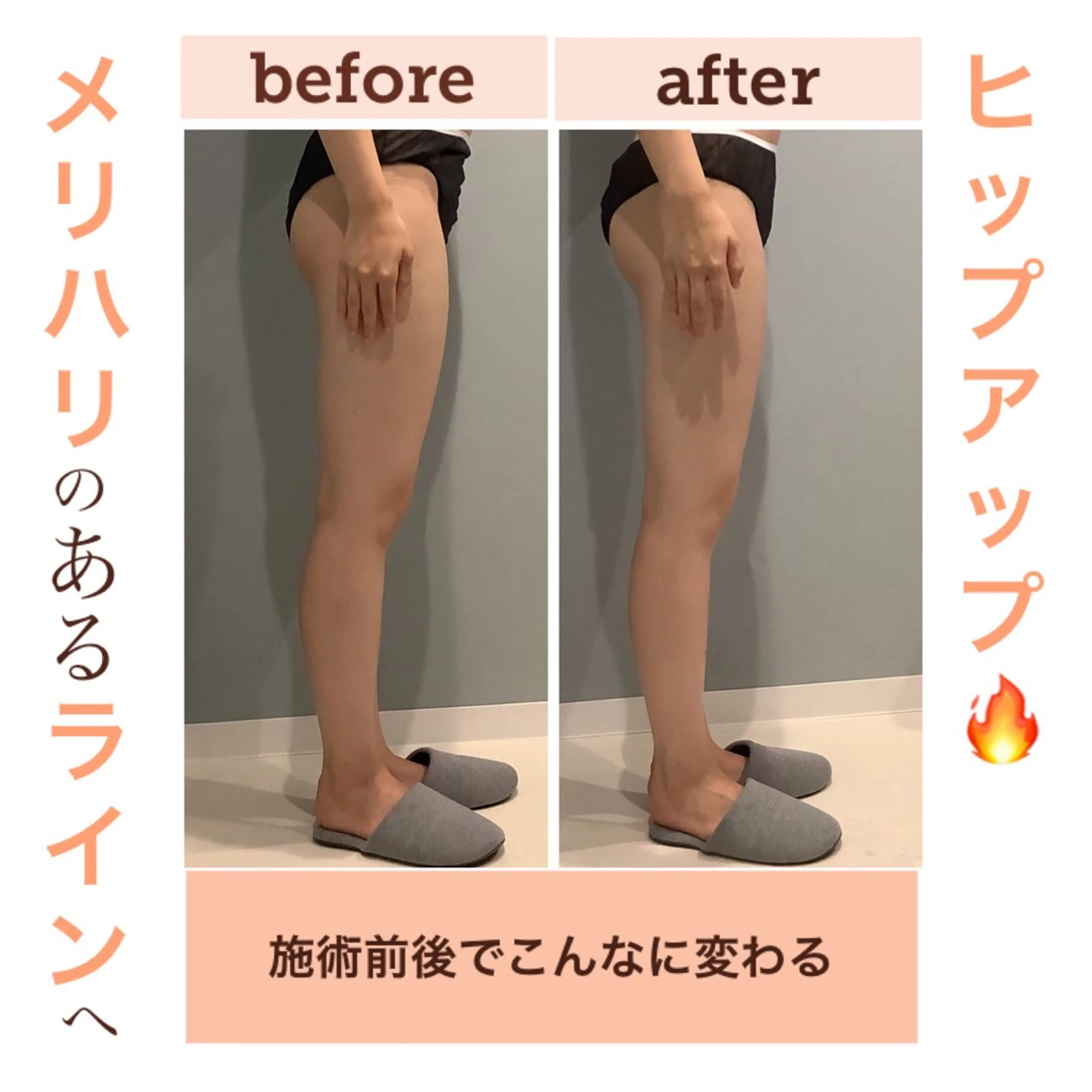 エステ エステサロン JURISのエステ・リラクイメージ