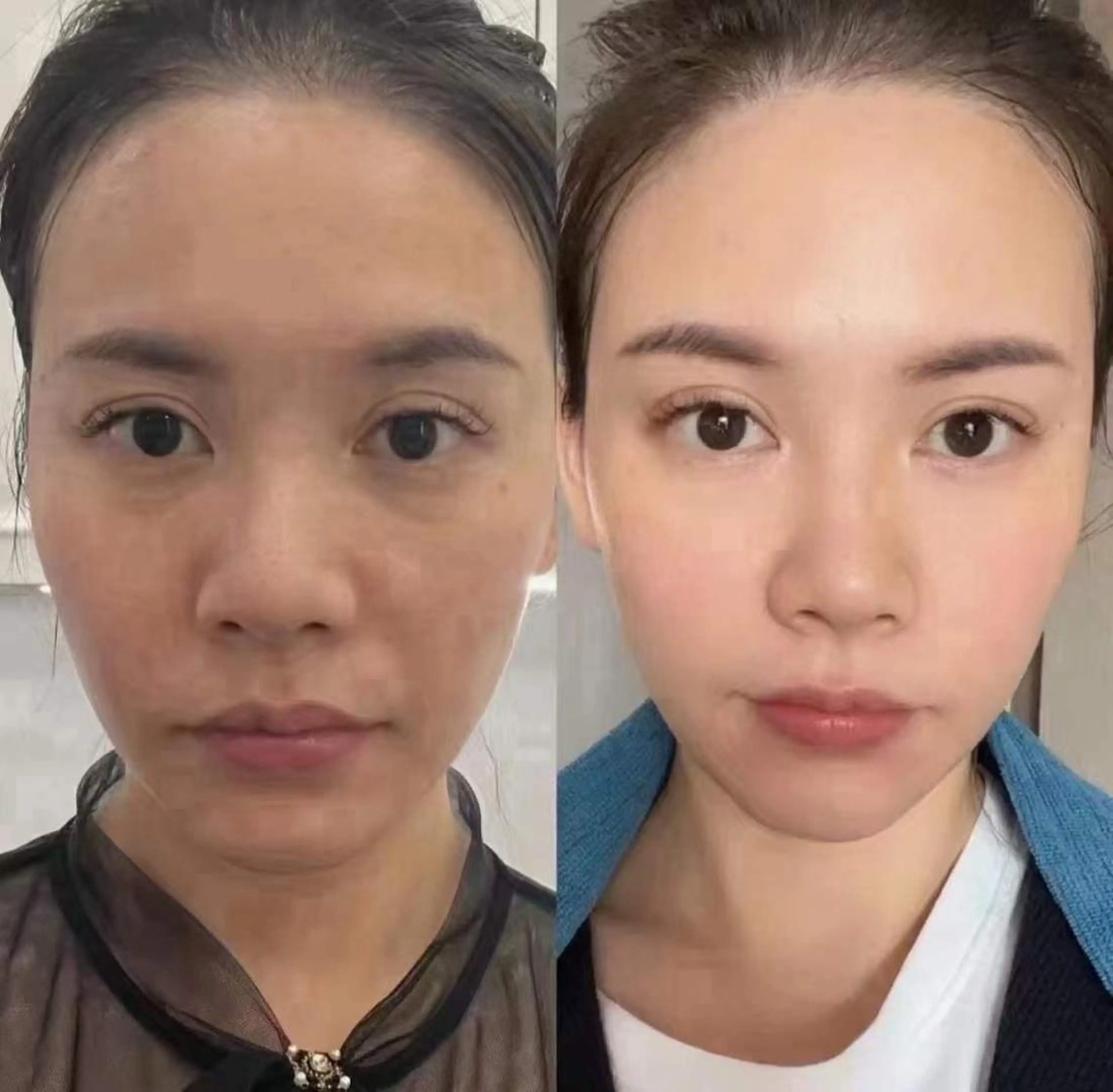 ネイル マツエク・マツパ エステ aliaハイフ&水光ジェットサロン所属・aliaハーブ水光店 エステティシャン募集のエステ・リラクイメージ