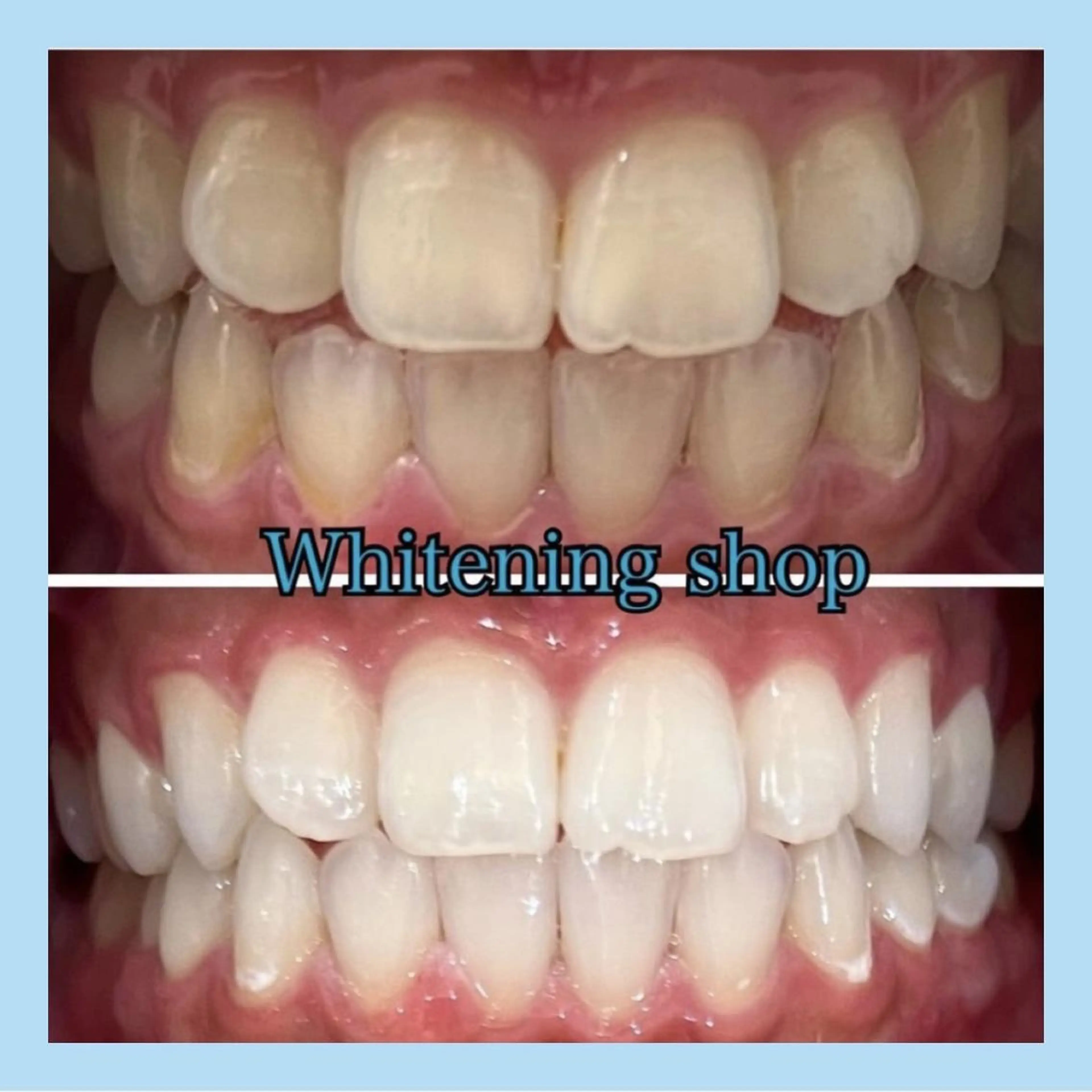 ホワイトニング ショップ千葉店のその他イメージ