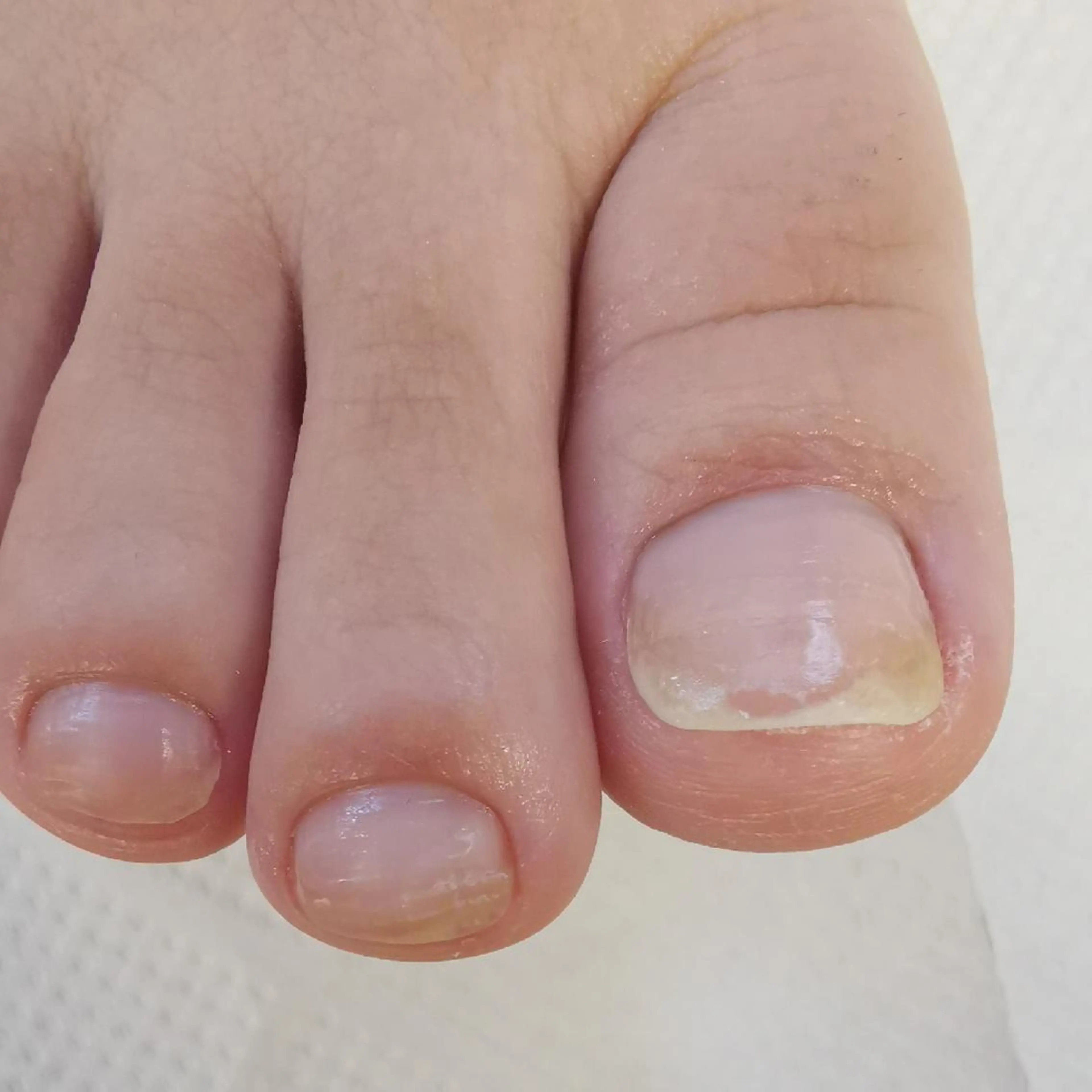 ネイル ネイルチップ フットネイル reve あやののネイルデザイン