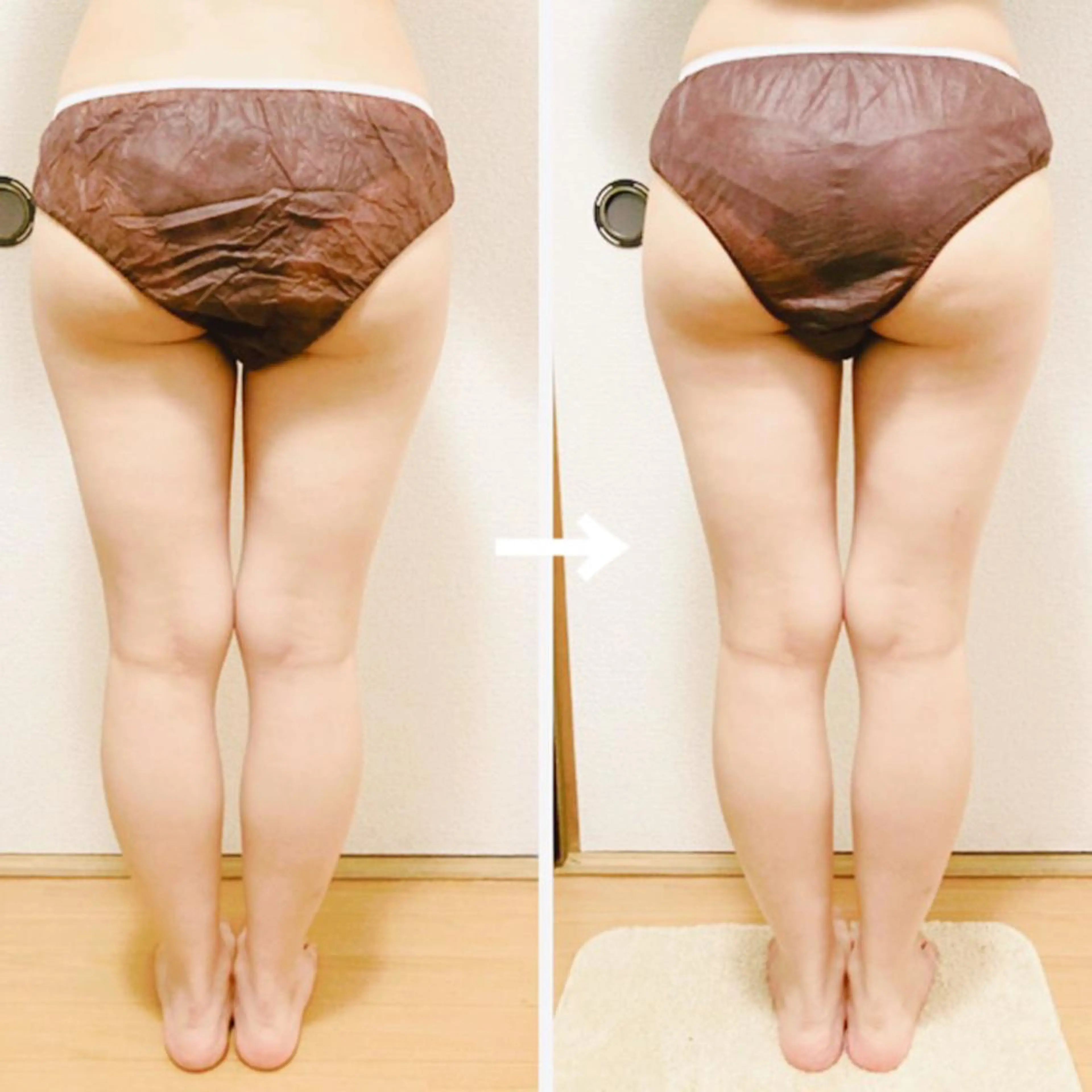 【ご新規様限定3回来店‼️】美脚コース45分×3回の写真