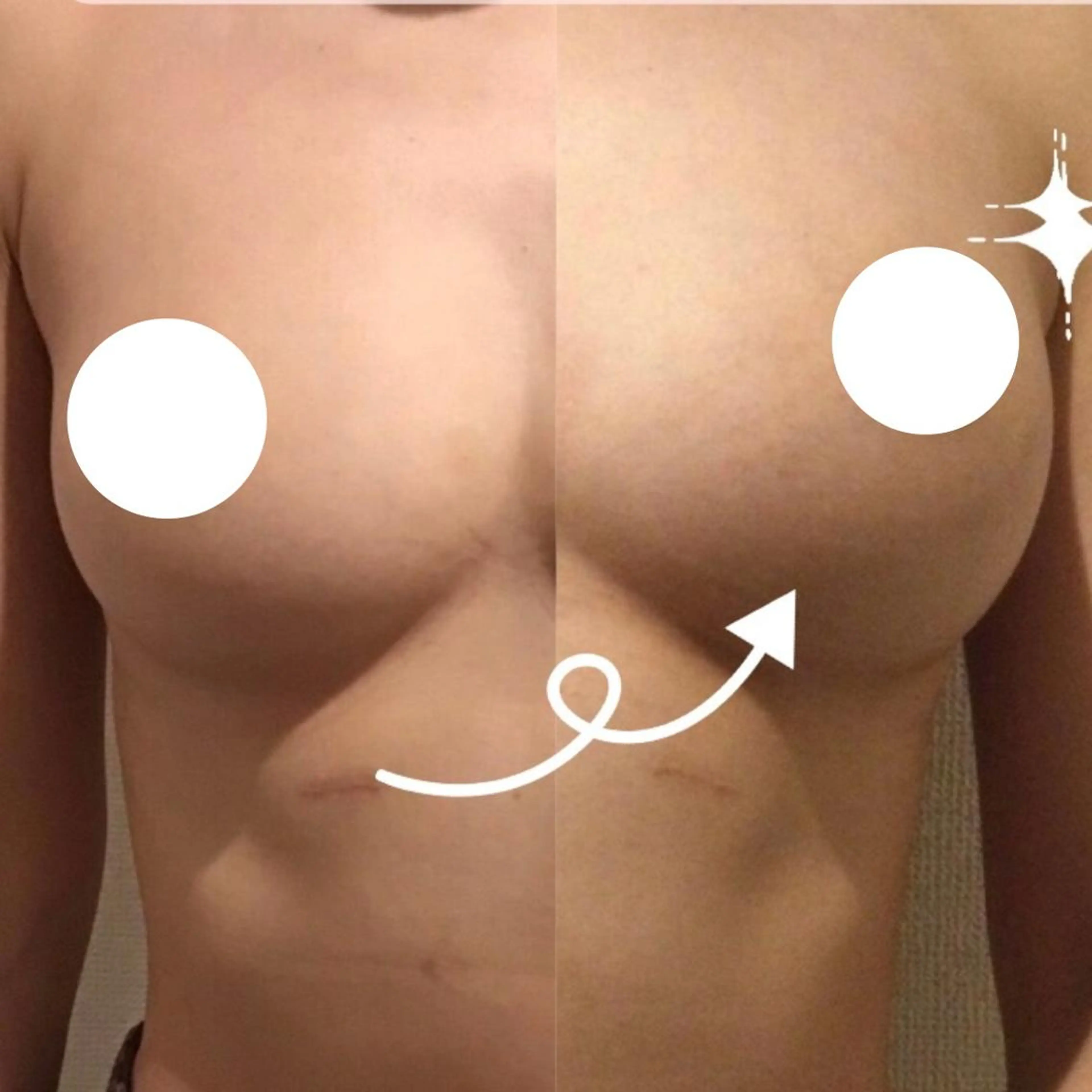 バスト・脱毛・痩身 上島のエステ・リラクイメージ