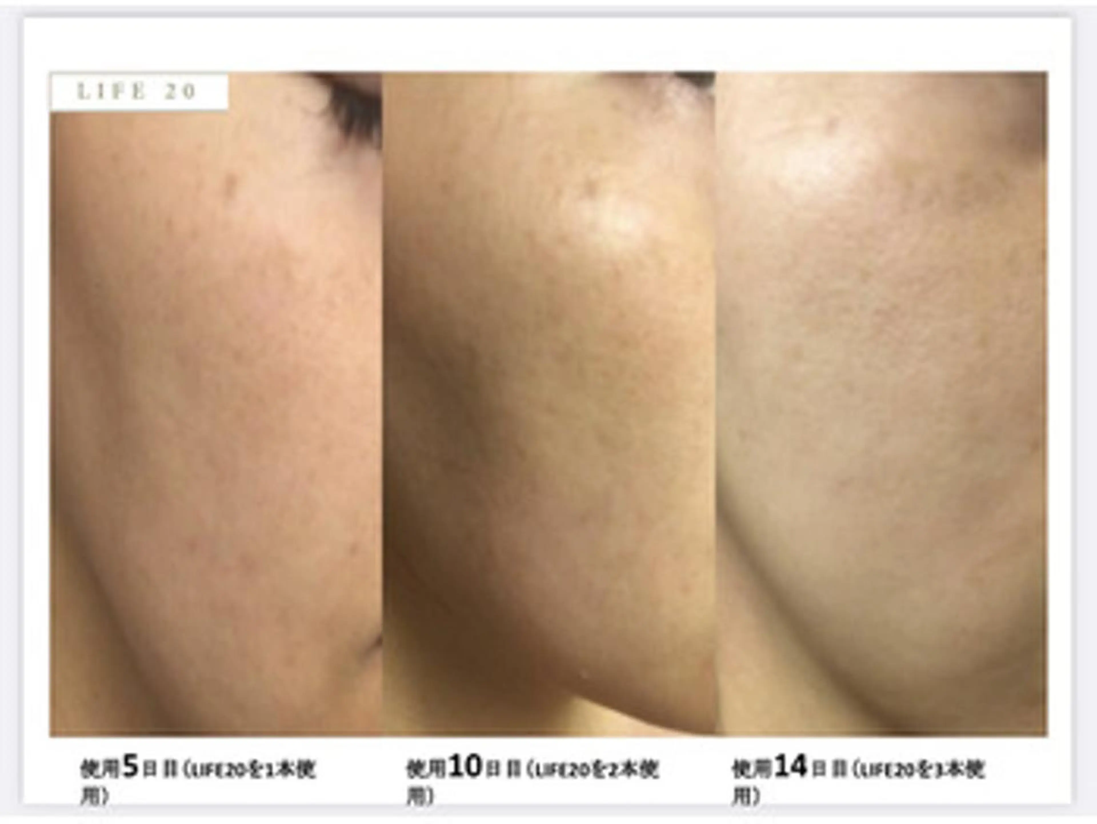 トラブル肌専門店 PLACE梅田堂山店のエステ・リラクイメージ