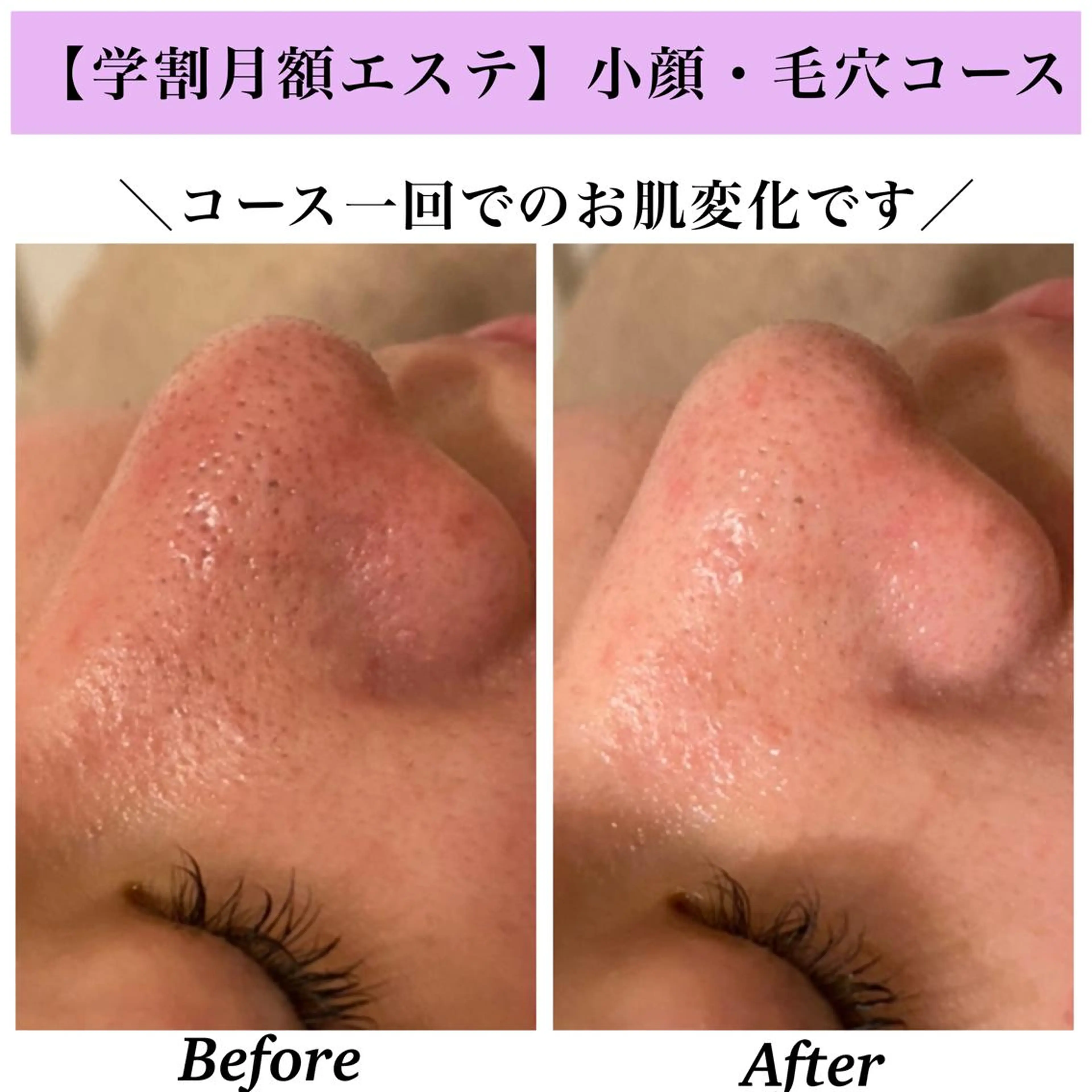 Bellesthe （ベルエステ）のエステ・リラクイメージ