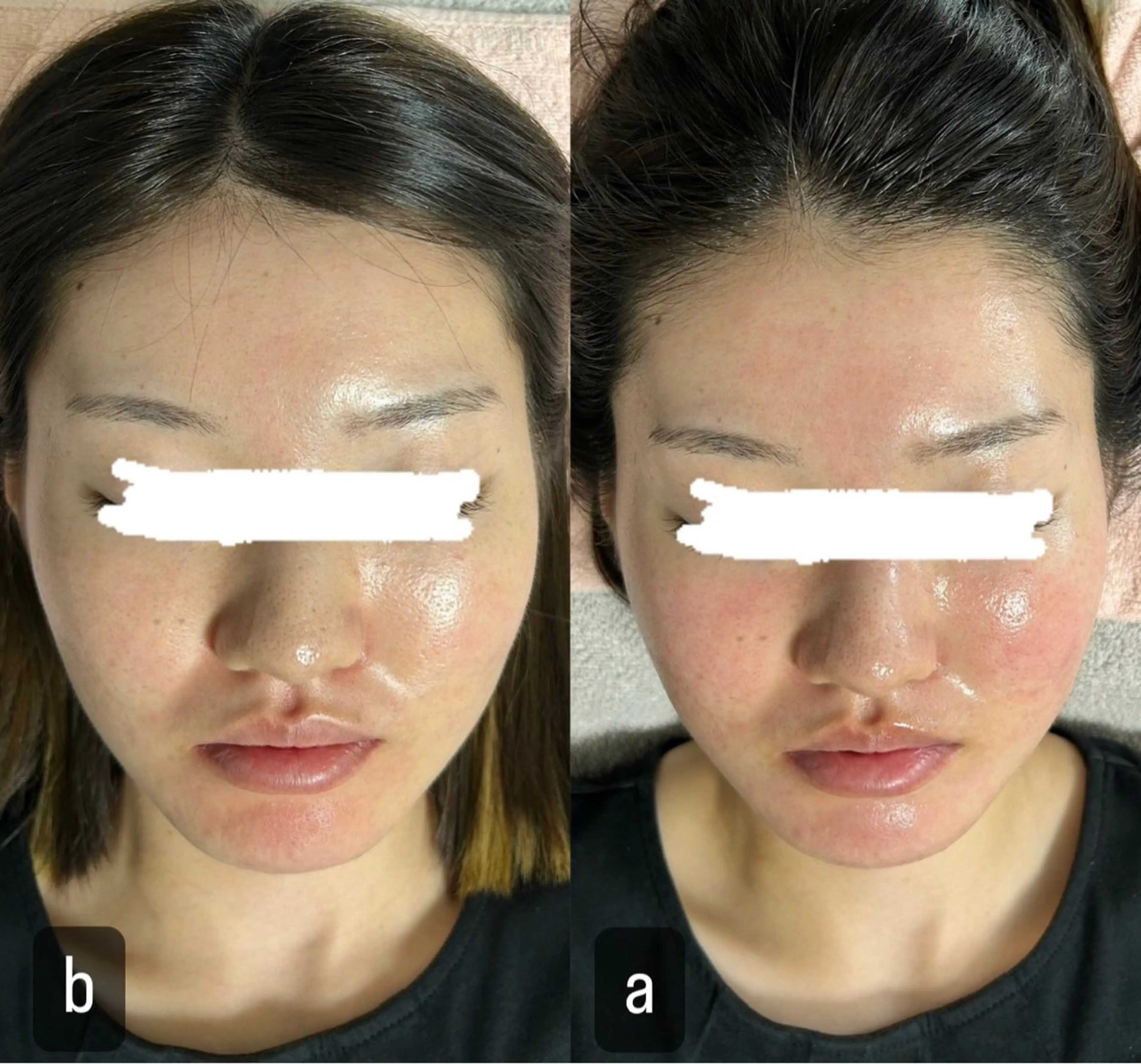 217whitening  room所属・217 ホワイトニングルームのエステ・リラクイメージ