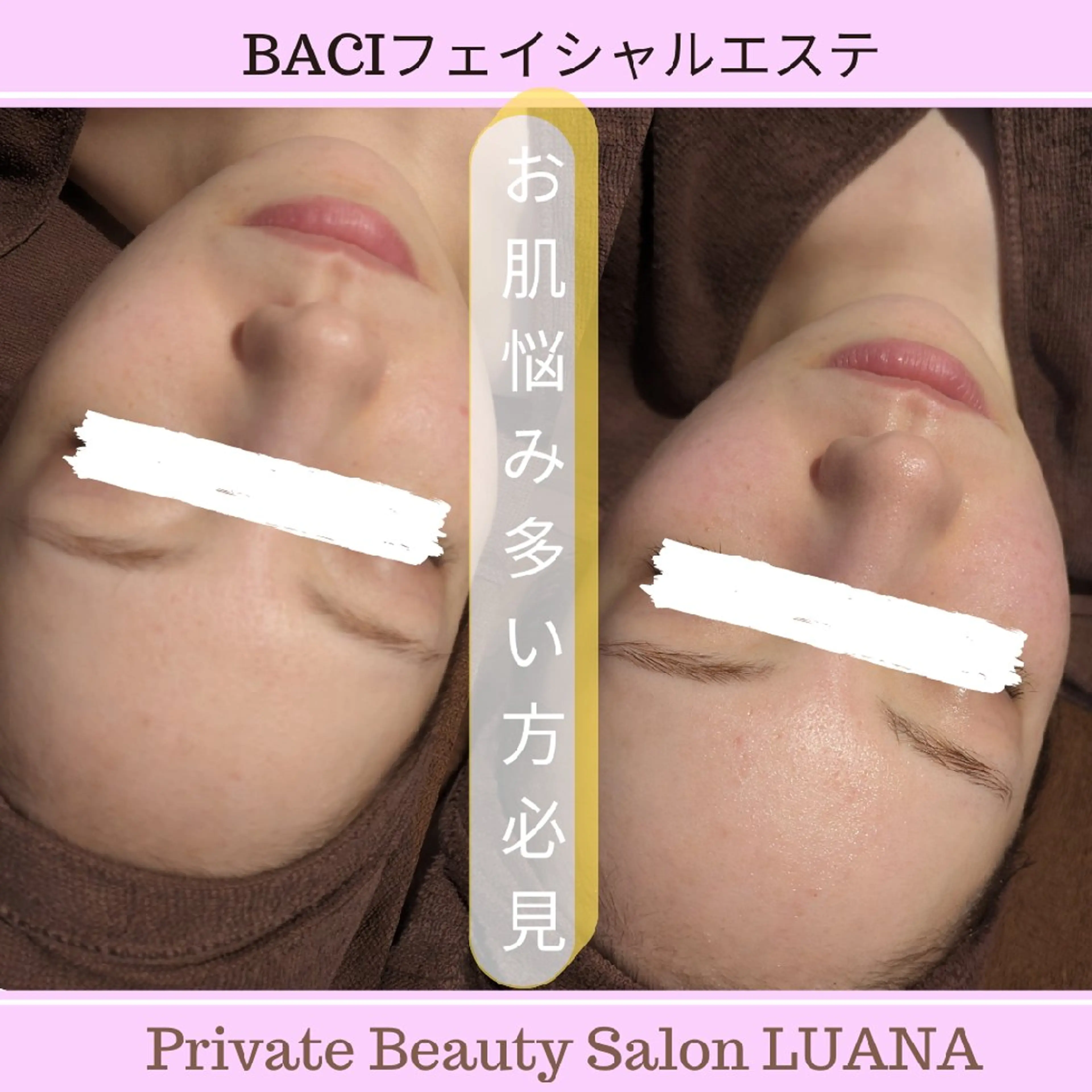 エステ 肌管理専門！BACI 加盟店LUANAのエステ・リラクイメージ